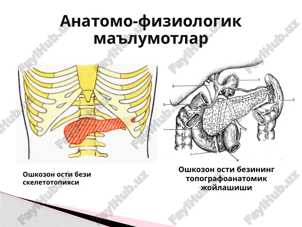 еатит классификацияси: уткир панкреатитнинг узаро бир-бирига боглик булган сабаблари: механик нейрогуморал токсикоаллергик без йули ичи гипертензияси билиар-панкреатик рефлюкс ун икки бармок ичак дискинезияси травмадан кейинги безнинг интраоперацион жарохатлари. механик сабаблар безнинг гуморал секрецияси (куп овкатланиш, алкоголь) гормонотерапия стресс холатлари нейрогуморал сабаблар инфекция аллергия иммунологик бузилишлар дори-дармонлар таъсири токсико-аллергик сабаблар макроскопик текширилганда без хажми катталашган, шишган булади. шиш корин пардаси оркасидаги тукимага ва кундаланг чамбар ичак туткичига таркалиши мумкин. корин бушлигида ва чарви халтасида аксарият сероз-геморагик суюклик булади. гистологик текширилганда оралик тукима шиши, унчалик катта булмаган кон куйилиш зоналари ва без тукимасида уртача ифодаланган дегенератив узгаришлар топилади. уткир шишли панкреатит (интерстициал панкреатит) макроскопик текширилганда без хажми катталашган, кескин шишган, булакчали структурасининг йуколиши, махаллий кон куйилиш учоклари борлиги, безда, корин парда орти клетчаткасида, ичак туткичларда ва кукс оралигида стеатонекроз доглари пайдо булиши билан характерланади. корин бушлигида 200 мл га якин сероз-геморрагик суюклик аникланади. ёгли панкреонекроз ёгли панкреонекроз; макропрепарат бунда меъда ости бези …