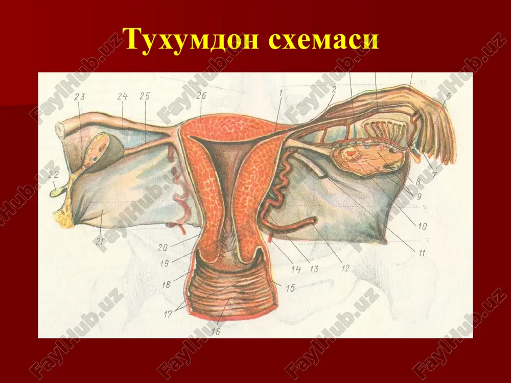 ёш. оғриқ синдроми ҳайз циклининг бузилиши (менорраги, задержка менструации) кўп ҳолларда менструал ва детород функция бузилмаган бессимптом кечиши тухумдон кистаси давоси консерватив даво: 3-6 менструал цикл давомида динамик кузатув яллиғланишга қарши терапия сўрилтирувчи терапия гормонал терапия фитотерапия 2. оператив даво: лапароскопия орган сақловчи принцип –кистани олиб ташлаш (цистэктомия) тухумдон некрозида – тухумдон понасимон резекцияси амалга оширилади. тухумдон некрози лапароскопия цистэктомия тухумдон кистаси асоратлари киста капсуласига қон қуйилиши киста капсуласига қон қуйилиши ва гематома оёқчаларининг буралиши оёқчаларининг буралиши ника тухумдон ўсмалари (кистомалар) кистома, «чин» тухумдон ўсмаси –капсулага эга, зич консистенцияли, пролиферация ҳамда малигнизация хусусиятига эга ўсмасимон ҳосила келтириб чиқарувчи омиллар кичик чаноқ аъзоларининг сурункали яллиғланиш касалликларини кечирган аёллар гормонал дисбаланс анамнезида тухумдонида операция ўтказган аёллар (цистэктомия) ирсий мойиллик сут бези рак касалликлари мавжуд аёллар ҳомиладорлиги патологик кечган аёллар эпителиал ўсмалар (цистаденомалар) сероз кистома сероз папилляр кистома муциноз кистома эндометриоидли кистома сероз цистаденома – диаметри 0.3 – 35 смгача бўлиб, бир ёки …