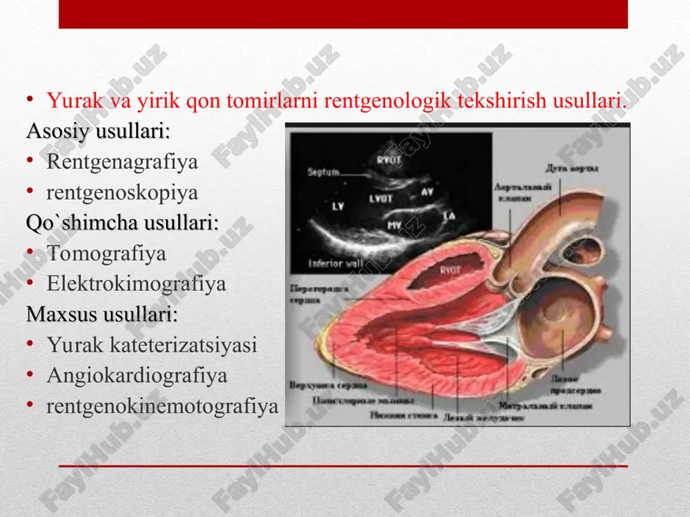 zi kombinirlangan mitral nuqsoni aortal klapn yetishmovchiligi aortal teshik stenozi 3. yallig’lanish kasalliklari. miokardit perikardit ->yopishqoq va ekssudatsiyali bo’lmachalararo nuqson (7-15% hollarda uchrydi) rentgenologik belgilari o’pka arteriyasi soyasi va o’pka ildizi soyasini kuchayishi o’pka tasvirini kuchayishi o’pka ildizi aktiv pulsatsiyaga egaligi qorinchalararo nuqson yurak mitral konfiguratsiyasi o’pka tasviri kuchaygan o’pka ildizi kuchaygan yurak beli qayd etilmaydi o’pka arteriyasi va yoyi bo’rtgan. fallo tetrada 4 ta nuqsondan iborat: -o’pka arteriyasi stenozi -qorinchalararo to’siq nuqsoni -aorta dekoarktatsiyasi -o’ng qorincha gipertrfiyasi quydagi rentgenologik belgilar kuzatiladi. -chap konturda ii yoyning botib ketishi -o’pka ildizi soyasi kichiklashuvi -o’pka tasviri noaniqligi -o’pka yorug’ligi kuchaygan -yurakning chapga kengayishi -yurak cho’qqisi kengayib yuqoriga kutarilgan -yurak etikcha shaklida mitral klapn stenozi -chap bo’lmacha kattalashuvi -o’pka arteriyasini bo’rtishi -o’ng qorincha kattalashuvi -chap qorincha kichiklashuvi -qizilo’ngach kichik radius bo’yicha orqaga surilgan aortal klapn etishmovchiligi -chap qorincha kengaygan -aortaning yuqoriga kutariluvchi qismi bir tekis kengayishi -chap qorincha qisqarishlari tezlashadi va chuqurlashadi -o’tirgan …