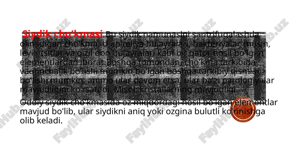 sistit, buyrak tuberkulyozi, interstitsial nefrit, gidronefroz, buyrak infarkti, o'sma nekrozi, buyrak kistalarining yorilishi va boshqa holatlarda paydo bo'lishi mumkin. oq qon hujayralari yoki leykotsitlar. leykotsitlar siydik cho'kmasida 0-5 p / s gacha kuzatilishi mumkin.leykotsitlar sonining o'zgarishi infektsiya yoki yallig'lanishni ko'rsatishi mumkin. siydikdagi oq qon hujayralarining ko'payishi leykotsituriya deb ataladi.pioositlar yoki sintillatuvchi leykotsitlar (granulyatsiyalangan leykotsitlar) mavjudligi piolefrit holatlarida keng tarqalgan.  epiteliy hujayralari.qisqichbaqasimon epiteliya hujayralarining ko'rinishi siydik cho'kindisida normal hisoblanadi.hujayraning shakli ularning qaysi anatomik joydan kelganligini ko'rsatadi. masalan, mayda, yumaloq, ko'p qirrali hujayralar buyrak tubulalaridan, perifora, shpindel yoki o'tish hujayralari buyrak tos suyagi, siydik pufagi yoki siydik pufagidan keladi. siydik cho'kindi moddasini o'rganish natijalari: natijalarni talqin qilish davolovchi shifokorning ixtisosligi bo'lib, u har bir bemorning ishiga alohida e'tibor qaratadi:  • yosh;  • jinsi (erkak \\ ayol);  • jismoniy faollik darajasi;  • ish yuritish sohasi;  • hayot yo'li;  • umumiy salomatlik. siydik cho'kindilarining mikroskopini tahlil qilish …