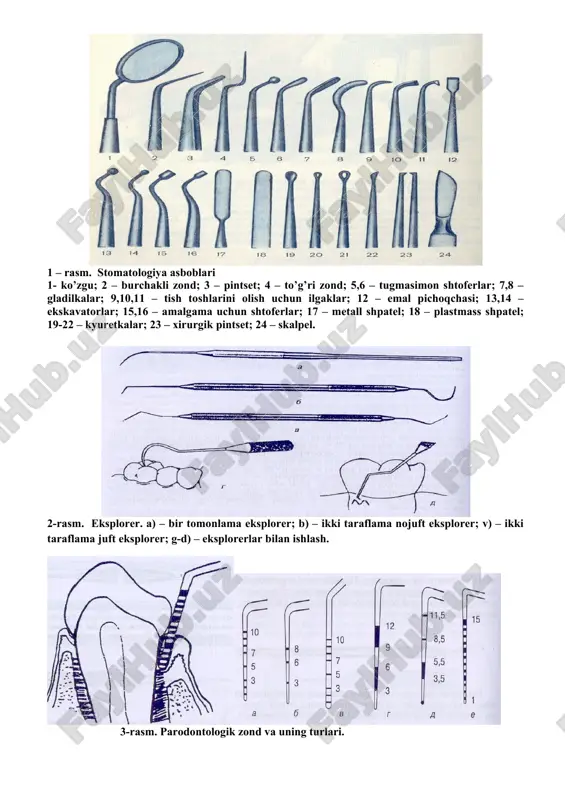 4. tish toshlarini olish uchun 5. endodontik asboblar 1 – rasm. stomatologiya asboblari 1- ko’zgu; 2 – burchakli zond; 3 – pintset; 4 – to’g’ri zond; 5,6 – tugmasimon shtoferlar; 7,8 – gladilkalar; 9,10,11 – tish toshlarini olish uchun ilgaklar; 12 – emal pichoqchasi; 13,14 – ekskavatorlar; 15,16 – amalgama uchun shtoferlar; 17 – metall shpatel; 18 – plastmass shpatel; 19-22 – kyuretkalar; 23 – xirurgik pintset; 24 – skalpel. 2-rasm. eksplorer. a) – bir tomonlama eksplorer; b) – ikki taraflama nojuft eksplorer; v) – ikki taraflama juft eksplorer; g-d) – eksplorerlar bilan ishlash. embed pbrush 3-rasm. parodontologik zond va uning turlari. ortopediya so’zi ikkita grekcha so’z o’zagidan iborat bo’lib, orthos — to’g’ri va paideuo — tarbiyalamoq yaratmoq degan ma’nolarni anglatadi. ilgarilari ortopediya deganda tibbiyotning bolalarning odatdan tashqari qiyshiq o’sadigan oyoq-qo’llari va umurtqalarini davolash bilan shug’ullanuvchi bo’limi tushunilar edi. ortopedik stomatologiya umumiy ortopediyaning bir bo’limi bo’lib, stomatologiyaning esa ancha keng, …