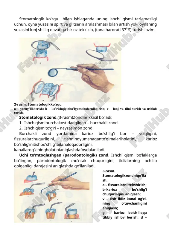 gilgan – burchakli zond. 2. ishchiqismito’g’ri – nayzasimon zond. burchakli zond yordamida karioz bo’shlig’i bor – yo’qligini, fissuralarchuqurligini, tishningyumshaganto’qimalariholatini, karioz bo’shlig’initishbo’shlig’ibilanaloqadorligini, kanallarog’ziningholatinianiqlashdafoydalaniladi. uchi to’mtoqlashgan (parodontologik) zond. ishchi qismi bo’laklarga bo’lingan, parodontologik cho’ntak chuqurligini, ildizlarning ochilib qolganligi darajasini aniqlashda qo’llaniladi. 3-rasm. stomatologikzondniqo’llash. a – fissuralarni tekshirish; b–karioz bo’shlig’i chuqurli-gini aniqlash; v – tish ildiz kanal og’zi-ning o’tuvchanligini aniqlash; g – karioz bo’sh-liqqa tibbiy ishlov berish; d – tish pulpasi-ning sezuvchanligini aniqlash; ye – milk «cho’ntagi» chuqurligini aniqlash. stomatologik pintset. pintset - ishchi qismi o’tmas burchak ostida egilgan, ichki yuzasi ko’ndalang chiziqli yoki silliq yuzali bo’ladi. pintset yordamida paxta bolishchalari og’iz bo’shlig’iga olib kiriladi va olib tashlanadi, karioz bo’shliq va tish bo’shlig’iga tibbiy ishlov berish, tishlarning qimirlash darajasini aniqlash va mayda endodontik asboblarni olib quyishda foydalaniladi (4-rasm). 4-rasm. stomatologik pintset bilan ishlash usuli. a)–paxta bolishchalarini ushlash; b) – mayda asboblarni olish; v) – tishning qimirlash daraja-sini aniqlash; g) – karioz bo’shliqda tibbiyi …