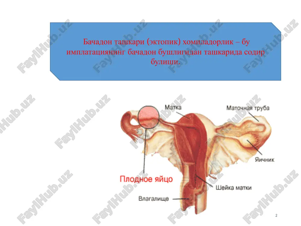 in orkali tekshiruv: 13 nay erilishini klinikasi bachadon bir oz kattalashgan, yumshokrok, («suzaetgan» bachadon) bachadon buyini xarakatlanganda kuchli ogrik kuzatiladi xarakatchan kinning orka gumbazi yassilashgan eki burtib chikgan palpatsiyada keskin ogrikli nay abortning klinikasi 14 korin pastida xurujli ogrik konli ajralma kiska muddatli xushdan ketish diagnostikasi shikoyati: •xayz kurmaslikka •patologik kon ketishga jinsiy yullardan •korin pastida ogrik anamnezdan: •yalliglanish kasalliklari •bepushtlik (birlamchi, ikkilamchi) •utkazilgan operatsiyalar kichik chanok a'zolarida 15 diagnostika usullari 16 1. xgt mikdorini aniklash konda xgtning ortib borishi normal va patologik xomiladorlikni farklashga erdam beradi. normal xomiladorlikda xgt konda xar 2 kunda ikki barovar oshadi. 2. exografiya tekshirish 3. orka gumbaz punktsiyasi 4. endometriyani gistologik tekshirish davolash 17 operativ konservativ • operatsiya • kon ketish, gemorragik shok, kon yukotishga karshi chora tadbirlar • operatsiyadan keyingi davrni olib borish • reproduktiv faoliyatni reabilitatsiya kilish kompleks xomilani ampulyar kismida joylashkani. laparoskopiya. 18 xomilani bachadon nayining istmik kismida joylashishi. laparoskopiya. 19 …