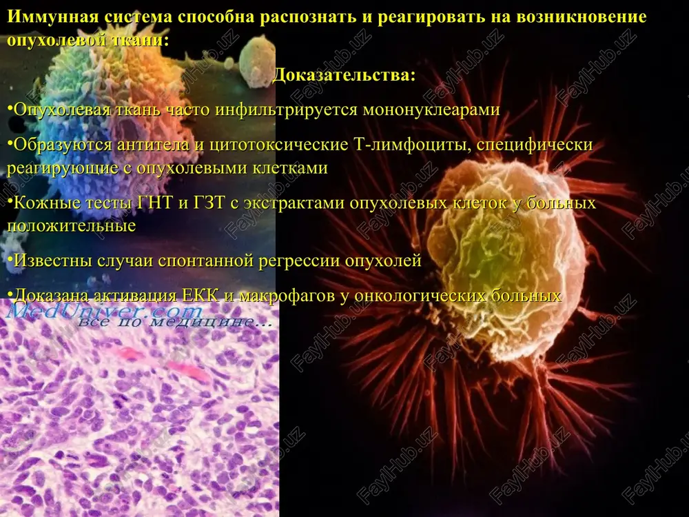ptsiya – povrejdeniya (v genax) mexanizmov, reguliruyushix belki rosta – effekt kantserogenov, ne vliyayushix na geneticheskiy apparat kletok kontseptsiya otkaza immunologicheskogo nadzora – utrata immunnoy sistemoy sposobnosti raspoznavat antigeni, poyavlyayushiesya v rezultate povrejdeniy dnk na opuxolevix kletkax v rezultate immunosupressii, progressiruyushego snijeniya immunnoy reaktivnosti. odnako, timektomiya ne privodit k povisheniyu chastoti vozniknoveniya opuxoley. geneticheskie mexanizmi kantserogeneza mutatsiya s perenosom onkogena v aktivnuyu oblast translyatsiya onkogena amplifikatsiya (usilenie) onkogena inaktivatsiya supressornogo gena nekontroliruemoe delenie kletki disfunktsii immunnoy sistemi sposobstvuyut vozniknoveniyu opuxoley osobennosti, svoystvennie opuxolyam antigeni opuxoley: -fetoprotein (gepatotsellyulyarniy rak), rakovo-embrionalniy antigen (zlokachestvennie opuxoli tolstoy kishki) spetsificheskie antigeni – svoystvenni tolko otdelnim opuxolyam, nemnogochislenni (naibolee izucheni mage, bage) rastvorimie opuxolevie antigeni – tsirkuliruyut vo vnutrenney srede i «otvlekayut» immunnuyu sistemu ot ataki opuxoli toksinvivodyashiy glikoprotein – obespechivaet udalenie toksicheskix i ximioterapevticheskix veshestv iz opuxolevix kletok uglevodi – sposobstvuyut preodoleniyu opuxolevimi kletkami stenok venul, proniknovenie ix v drugie tkani i metastazirovaniyu lektini – …
