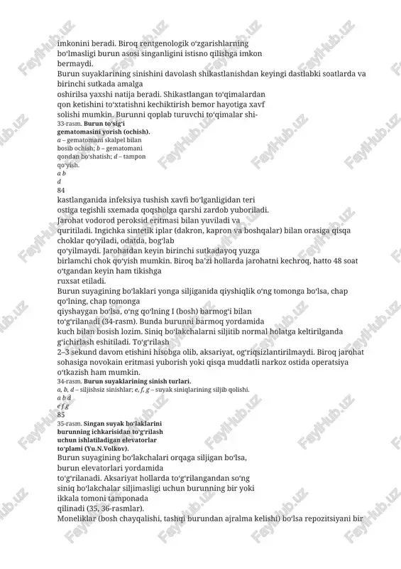 i (33-rasm). teri ostida havo krepitatsiyasining borligi g‘alvirsimon suyakning sinib, shilliq pardaning yirtilganidan dalolat beradi. burunni qoqqanda havo burundan jarohatlangan to‘qima orqali yuz terisi ostiga kiradi. burundan likvor kelishi elaksimon plastinka singanidan darak beradi. 83 rentgenologik tekshirish odatda yumshoq to‘qimalar qattiq shishganda va infiltratlanganda burun va yuz suyaklarining qanchalik singanligini hamda tabiatini aniqlash imkonini beradi. biroq rentgenologik o‘zgarishlarning bo‘lmasligi burun asosi singanligini istisno qilishga imkon bermaydi. burun suyaklarining sinishini davolash shikastlanishdan keyingi dastlabki soatlarda va birinchi sutkada amalga oshirilsa yaxshi natija beradi. shikastlangan to‘qimalardan qon ketishini to‘xtatishni kechiktirish bemor hayotiga xavf solishi mumkin. burunni qoplab turuvchi to‘qimalar shi- 33-rasm. burun to‘sig‘i gematomasini yorish (ochish). a – gematomani skalpel bilan bosib ochish; b – gematomani qondan bo‘shatish; d – tampon qo‘yish. a b d 84 kastlanganida infeksiya tushish xavfi bo‘lganligidan teri ostiga tegishli sxemada qoqsholga qarshi zardob yuboriladi. jarohat vodorod peroksid eritmasi bilan yuviladi va quritiladi. ingichka sintetik irlar (dakron, kapron …