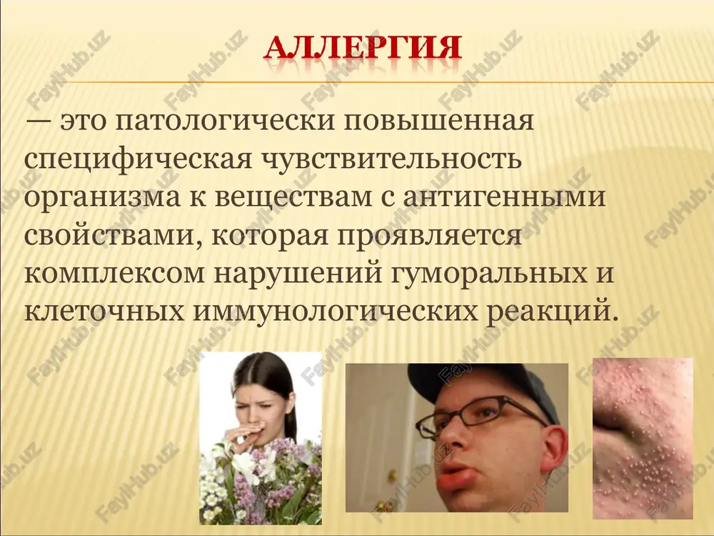 ushix kletki, tkani i organi. naibolshee rasprostranenie poluchila klassifikatsiya, predlojennaya kukom (1947 g.), v kotoroy videleni: 1) allergicheskie reaktsii nemedlennogo tipa (giperchuvstvitelnost, ili povishennaya chuvstvitelnost nemedlennogo tipa); 2) allergicheskie reaktsii zamedlennogo tipa (giperchuvstvitelnost, ili povishennaya chuvstvitelnost zamedlennogo tipa). v osnovu klassifikatsii kuka polojeno vremya poyavleniya reaktsii posle kontakta s allergenom. reaktsii: - nemedlennogo tipa razvivayutsya v techenie 15—20 minut, - zamedlennogo tipa — cherez 1—2 sutok. eta klassifikatsiya ne oxvativaet vsego raznoobraziya proyavleniy allergii. poetomu razlichiya mejdu allergicheskimi reaktsiyami stali svyazivat s raznimi mexanizmami ix razvitiya. iz chisla klassifikatsiy, osnovannix na patogeneticheskom printsipe, naibolshee rasprostranenie poluchila predlojennaya v 1968 g. djellom i kumbsom. videlyayut 4 tipa allergicheskix reaktsiy. kajdiy iz etix tipov imeet osobiy immunniy mexanizm i prisushiy emu nabor mediatorov, chto opredelyaet klinicheskuyu kartinu zabolevaniya. tipi allergicheskix reaktsiy po djellu i kumbsu tip naimenovanie prinimayut uchastie v reaktsii i anafilakticheskiy lge- i reje lgg4-antitela ii tsitotoksicheskiy lgg- i lgm-antitela …