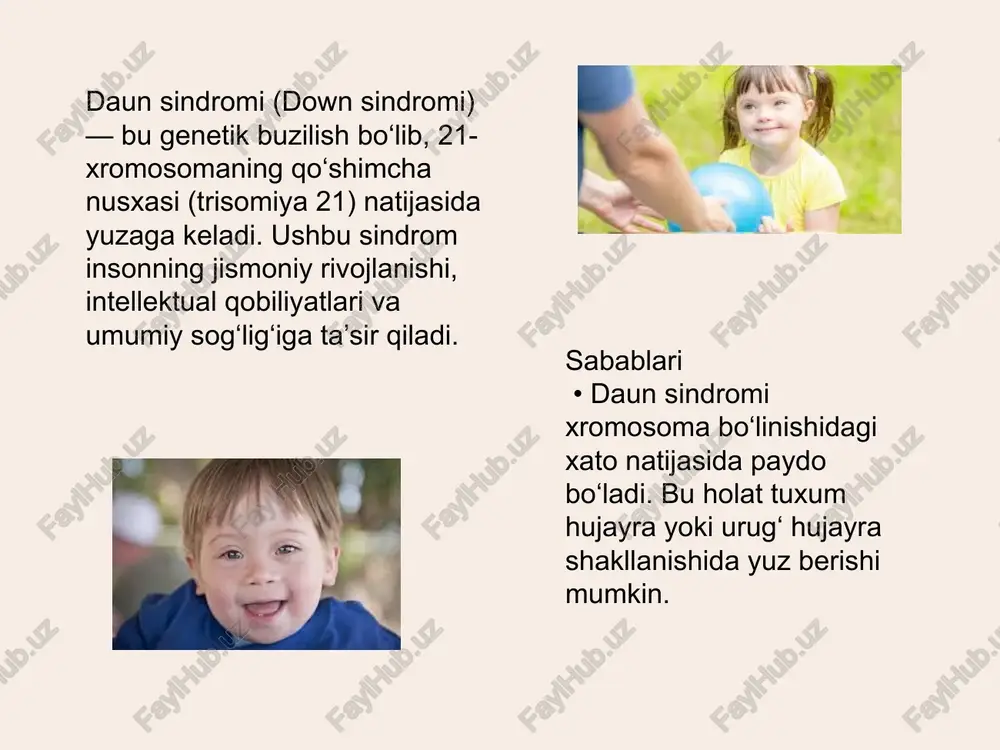 daun sindromi - Page 2
