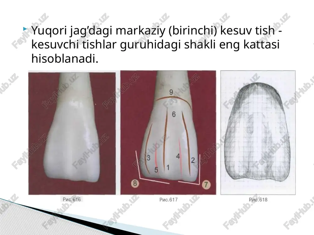 oldi qisimda birlashadi va o’rta tizma bo’lmaydi. tish tojining palatinal yuzasining bunday tuzilishi markaziy kesuv tishga belkurak shaklini beradi. palatinal yuzadagi barcha morfologik elementlar qirralari va tepaliklari bilinarsiz va barcha shakillari silliq liniyalar, yumaloq konturlar bilan ifodalangan. 622-medial yuza. 623-rasmda: 1- medial yuza (medialnaya poverxnost); 2- vestibulyar kontur (vestibulyarniy kontur); 3- palatinal kontur (nebniy kontur); 4- anatomik bo’yin (anatomicheskaya sheyka); vestibulyar yuza kesuv burchagida bir tekkis silliq qiyalikka ega, palatinal kontur bo’yin oldi qismida bo’yin kamari tufayli qavariq. o’rta va kesuv tomonining 3 dan bir qismi botiq holda. 624-distal yuza. 625-rasmda: 1- distal yuza (medialnaya poverxnost); 2- vestibulyar kontur (vestibulyarniy kontur); 3- palatinal kontur (nebniy kontur); 4- anatomik bo’yin (anatomicheskaya sheyka); distal yuzaning o’rta qismida medialga qaraganda ancha rivojlangan distal tizma ko’rinadi, bu esa distal aloqa yuzasida yumaloq va ozgina bo’rtib ko’rinadi. image1.jpeg image2.jpeg image3.jpeg image4.jpeg image5.jpeg puc.616 puc.617 puc.618 puc.619 puc. 620 puc.621 puc, 622 puc. 623 puc. 624 …