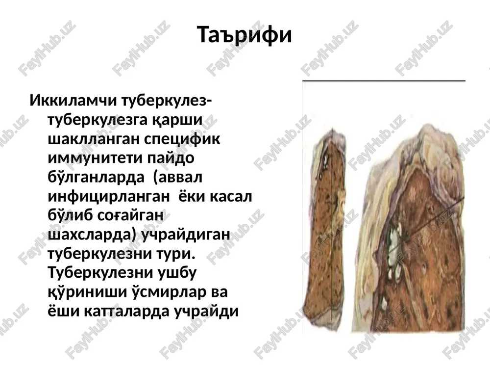 lda shikastlanishi bilan boshlanadi, keyinchalik esa o'pka parenximasida yangi o'choklar paydo bo'la boshlaydi. ekssudativ yallig'lanish reaktsiyasi tez orada produktiv reaktsiya bilan almashadi o'choqli tuberkulezni endogen reaktivatsiya oqibatida shakllanishi odatda tuberkulez bo'yicha epidemiologik xolat yaxshilanganda kuzatiladi birlamchi tuberkulezdan keyin 1-3 yil o'tkandan keyin shakllanadi aksariyat bemorlarni o'pka parenximasida kaltsinatlar aniqlanadi birlamchi sil o'rnida kolgan sil mikobakteriyalarining kayta jonlanishi, ya'ni zski noaktiv koldiq o'zgarishlarning faollashishi natijasida rivoj topadi. ushbu koldiq o'zgarishlar ko'proq ko'ks oralig'i limfa tugunlarida uchraydi, chunki bunday sil uzok muddat davolashni talab kiladi va har doim ham ko'ngildagidek natija beravermaydi. bunday hollarda sil kasalligining faollashishida infektsiyaiing limfogen yo'l bilan tarqalishi etakchi o'rin tutadi. shu bilan bir katorda o'pka to'qimasida gematogen disseminaiiya evaziga paydo bo'lgan o'choklar ham bo'lishi mumkin. o'pka silining tarqoq turiga himioterapiya ѐrdamida davo qilinganda kasallik tez tuzala boshlaydi, kasallik o'chog'ining hajmi kichiklashadi. boshqa sil xastaligi turining kelib chiqiizida o'choqlarning tutgan o'rniga alohida baho berish kerak. shunisi dikqatga sazovorki, …