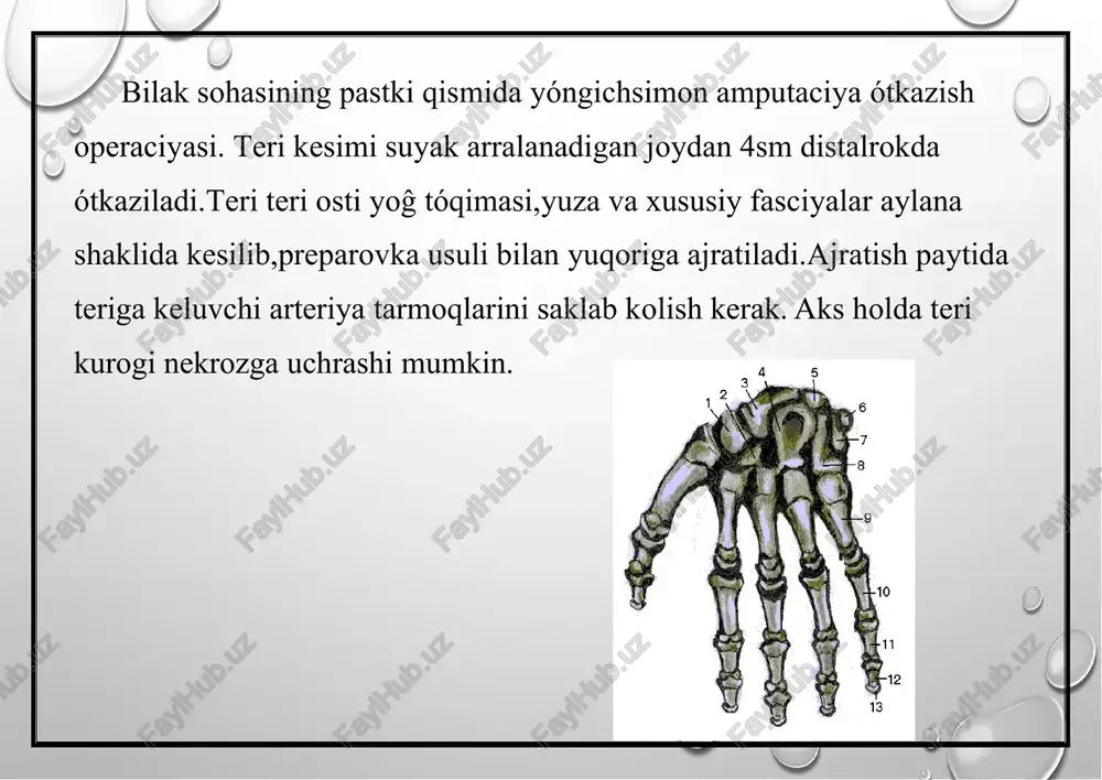 an tiqilib ularni ustidan bilak sohasi terisi tiqiladi. agar sohaning terisi etmay kolsa b.v.larin bόyicha ozod kόprok laxtagi olinib tiqiladi. bilak vatirsak suyaklariga tiqilgan mushaklardan hosil bόlgan barmoqlarning harakati bilak suyagi uchun elkani tasqi dόmboĝi tirsak suyagi uchun elkani tasqi dόmboĝi tirsak suyagi uchun esa ichki dόmboĝidan boshlanadi. barmoqlarni yaqinlashtiruvchi harakati yumalok pronatorni qiskarishidan hosil bόladi. barmoqlarning ekzoarticulyaciyalari barmoq falangalarining ekzoarticulyaciyalari. falangalarni ekzoartiqo‘lyaciya qilishdan oldin falangalararo bόĝim bόshliĝining teridagi tasviriy chiziqlarini aniqlashimiz kerak. v.n.shevkunenko bόyicha tirnoq falangasida όrta falanganing burtib chikkan qismidan 2mm,όrta falangada 4mm,asosiy falangada 8mm pastrokdan όtadi. yana bir usuli:tirnoq falangasi bόĝim bόshliĝini aniqlash uchun barmoq falangalari maksimal buqilib όrta falanga asosining όrta qismi topilib chiziq όtkaziladi.bu chiziqni tirnoq falangasining dorsal yuzasidan όtgan soha bόĝim bόshliĝining tasviriy chizigi aniqlanadi. tirnoq falangasining ekzoartiqo‘lyaciyasida teri kurogi kaft yuzasidan olinadi.buning uchun falanganing dorsal yuzasidan bόĝim tasviri bόyicha yumshoq tόqimalar kesilib amputaciya pichogi erdamida bόĝim qobigi kaft yuzasiga qarab kesiladi.keyin esa pichoqni …