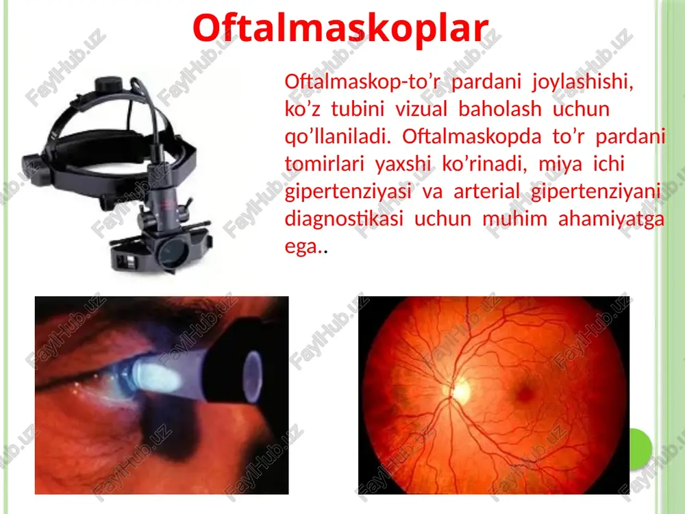 ajasini kamaytirishga erishiladi eksimerlazerli amaliyotda lazer nurini yo’naltirish uchun bu ma’lumotlar foydalaniladi. iol-master. hozirgi kunda katarakta olish operatsiyasidan keyin sun’iy gavhar ko’rsatkichlarini aniq baholash uchun iol-master lazerli optik biometriya qo’llaniladi. ko’z biomikroskopiyasi — optik muhitlar va ko’z to’qimalarini vizual tekshirish usuli. konyuktiva, shox parda, rangdor parda, ko’zning oldingi kamerasi, gavhar, shishasimon tana, ko’z tubining markaziy qismlarini ko’zdan kechirish maqsadida qo’llaniladi. (biomikrooftalmoskopiya). ko’z uzisi. bir qancha maqsadlarda qo’llaniladi. to’r parda ko’chishi yoki gavhar qatlami siljishining diagnostikasida uzi o’kazilishi mumkin. uzi yordamida ko’zda yot tana borligi ham ko’rinadi. ko’z uzi si ko’rish nervi pardalari holatini ko’rishda ahamiyatli. optik koregentli tomografiya. yuqori darajada ko’zning tiniq muhitlari tiriklikdagi optik tasvirini olishda qo’llaniladi. avtorefkeratometr ( unicos, yu. koreya) –juda yaxshi apparat. ko’zning barcha optik xarakterini tez, aniq ko’rsatadi. o’rnatilgan protsessor buni tez va aniq qiladi. apparat akkomodatsiya spazmi, astigmatizm xarakteri va boshlanishini, miopiya va gipermetropiya yengil darajalarini aniqlaydi. nazorat uchun savollar 1. ko’ruv organni vazafalarini …