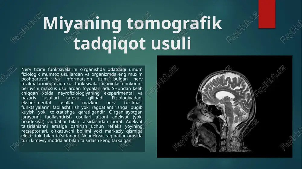 ppoz; oiv infektsiyasi; epilepsiya; sinüzit; miya tomirlarini anormal rivojlanishi; multipl skleroz; nörodejenerativ kasalliklar; selli hududning patologiyasi; praksis holat; miya tomirlarida qon aylanishini buzish; ko'prikning o'simtalari. magnit-rezonans tomografiya (mrt) magnit-rezonans tomografiya (mrt) — yadro magnit-rezonans hodisasi yordamida ichki organlar va to’qimalarni o’rganish uchun tomografik tibbiy tasvirlarini olishning bir usuli hisoblanadi. usul atom yadrolarining elektromagnit javobini, odatda vodorod atomi yadrolarining javobini o’lchashga asoslangan. ya’ni bunda yuqori kuchlanishdagi doimiy magnit maydonda muayyan elektromagnit to’lqinlar ta’siri tufayli yadrolarning qo’zg’alishi qayd etiladi. tarixi magnit-rezonansli tomografiya 1973-yil kashf etilgan deb hisoblanadi. o’sha vaqtda kimyo professori «nature» jurnalida «induktsiyalangan mahalliy o’zaro ta’sir yordamida tasvir yaratish; magnit rezonans asosidagi namunalar» deb nomlangan maqola chop etdi. keyinchalik, piter mansfield tasvir olish uchun matematik algoritmlarni takomillashtirdi. mrt usulini ixtiro qilganlik uchun har ikkala tadqiqotchi 2003-yilda tibbiyot bo’yicha nobel mukofotiga sazovor bo’ldi. biroq, mrt qurilmasi amerikalik olim doktor raymond damadyan tomonidan ixtiro qilinganligi haqida dalillar mavjud. bundan tashqari, 1960-yilda v. a. …