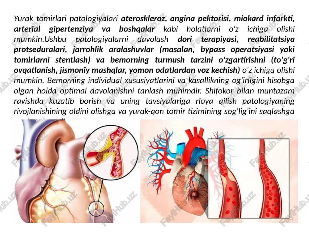 ishi, qon oqimining yomonlashishi va bosimning oshishi tufayli yurak-qon tomir kasalliklarini rivojlanishining asosiy xavf omillaridan biridir. 6. ** jismoniy harakatsizlik**:- muntazam jismoniy mashqlar va jismoniy faollikning etishmasligi yurak-qon tomir kasalliklarini rivojlanish xavfini oshirishi mumkin. 7. ** ovqatlanish**:-ortiqcha to'yingan yog', shakar va tuzni o'z ichiga olgan noto'g'ri ovqatlanish yurak-qon tomir kasalliklarini rivojlanishiga yordam beradi. 8. ** stress va depressiya**:-stress, depressiya va tashvish kabi psixologik omillar yurak-qon tomir tizimiga ta'sir qilishi va yurak xastaligi xavfini oshirishi mumkin. 9. ** genetik moyillik**:- irsiy omillar gipertoniya, ateroskleroz va boshqa kasalliklar kabi yurak-qon tomir kasalliklarining rivojlanishida rol o'ynashi mumkin. ushbu sabablar yurak-qon tomir kasalliklarining rivojlanishiga ta'sir qiluvchi asosiy omillardir va sog'lom turmush tarzini saqlash va yurak-qon tomir kasalliklarining oldini olishda ularni hisobga olish muhimdir. biomateriallar yurak-qon tomir patologiyalarini davolashda muhim rol o'ynaydi, chunki ular yurak va qon tomirlarining shikastlangan to'qimalarini tiklash va tiklash uchun implantlar va materiallar sifatida foydalanishga imkon beradigan maxsus xususiyatlarga ega. yurak-qon …