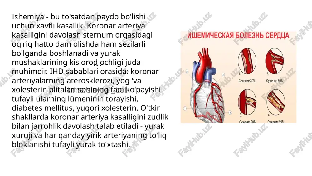 rognozlarga ega. ... t.me/slaydai_bot yurakning ishemik kasalligi — yurak-tomir sistemasining keng tarqalgan kasalligi; miokard ishemiyasi va koronar qon aylanishining buzilishi bilan kechadi. yurakning ishemik kasalligik.ga, asosan, koronar (toj) tomir arteriyalari aterosklerozi natijasida yurak muskullarida qon aylanishining yetishmay qolishi va shu tufayli yurakning qonga yolchimasligi sabab boʻladi. yurakning ishemik kasalligik.ga stenogkardiya (dastlabki, muqim, nomuqim), miokard infarkti, infarktdan keyingi kardioskleroz, aritmik tur va yurak yetishmovchiligi kiradi. yurakning ishemik kasalligik. muntazam rivojlanib boruvchi ogʻir yurak xastaligi hisoblanadi. yosh ulgʻaygan sari kasallik uchrashi koʻpayadi. ... t.me/slaydai_bot so'nggi yillarda ushbu sababdan o'limning kamayishi tendentsiyasi kuzatilmoqda. 2015 yildan beri yurak-qon tomir kasalliklaridan o'lim darajasi barcha o'limlarning yarmidan kamini tashkil etdi va kamayishda davom etmoqda. shunga qaramay, bu ko'rsatkich hali ham yevropa mamlakatlaridagi ko'rsatkichdan yuqori. qon aylanish tizimining kasalliklari dunyoning barcha rivojlangan mamlakatlarida o'limning asosiy sababi bo'lishiga qaramay, evropa ittifoqida yurak-qon tomir kasalliklaridan o'lim darajasi rossiyaga qaraganda sezilarli darajada past, yevropada 2015 yilda bu ko'rsatkich 36,7% ni …