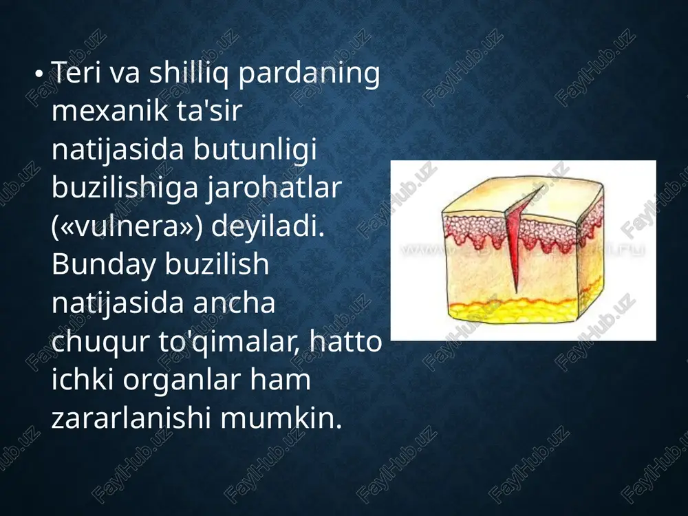hda hisobga olish kerak. masalan, sanchilgan, o'q tekkan jarohatlar ko'pincha kam qonaydi. ko'z bilan ularning chuqurligini aniqlash qiyin, ko'pincha ichki organlar shikasti bilan farqlanadi. o'tmas ashyolar, zont uchi, metall uchliklardan hosil bo'lgan sanchilgan jarohatlar kechishi boshqacha bo'ladi. kesilgan va chopilgan jarohatlar tashqi nuqsonlar kengligi, ko'p tashqi qon ketishi bilan xarakterlanadi. unlgan, ezilgan va yirtilgan jarohatlarda qon kam ketsa-da, ular kuchli og'riq beradi, ifloslanadi, ko'pincha ular to'qimalar mahalliy nekrozi, qon aylanishi buzilishi bilan kechadi. yengil urilish (lat yeyish) og'riq bilan kechsada, og'ir oqibatlarga olib kelmaydi. tishlangan jarohatlar faqat o'zining kattaligi, chuqurligi, yiringlashi bilan farqlansa-da, og'ir asoratga - quturish kasalligiga («lussa, rabies») olib keladi. quturish virusi quturgan hayvon so'lagi bilan u tishlab olganda jarohatga o'tadi. kalamush, sichqon, olmaxon va mushuklar tishlaganda «kalamush kasalligi» («sodoku») paydo bo'lishi mumkin. kesilgan jarohatlar o'tkir narsa (qurol) tekkanda yuz beradi, odatda atrofdagi to'qimalar zararlanmaydi. jarohat chetlarining bir-biridan ajralib turishi, to'g'riligi, jarohat uchlari esa o'tkir bo'lishi bilan farqlanadi. …