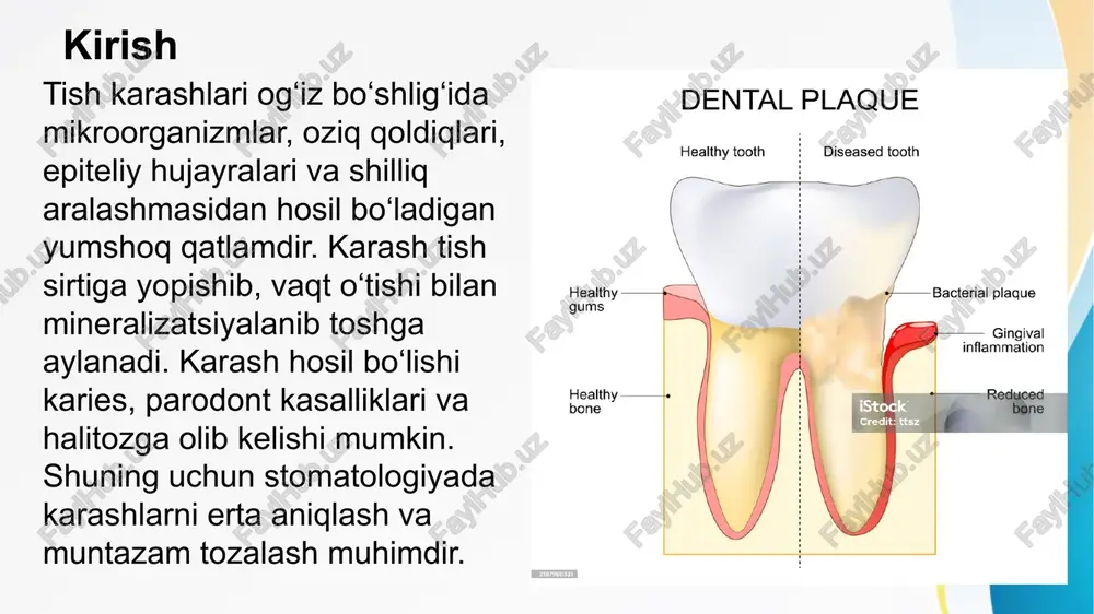 to‘qimalarini tekshirish (asosiy usullar) parodont to‘qimalarining holatini baholashda asosiy usullar qo‘llaniladi: klinik tekshiruv, parodontal zondlash, gigiyena ko‘rsatkichlarini aniqlash, tishlarning qimirlamasligini baholash. shuningdek, og‘iz bo‘shlig‘i shilliq qavati, gingiva ranggi va shish darajasi kuzatiladi. ushbu usullar yordamida kasallikning erta bosqichida tashxis qo‘yish mumkin bo‘ladi. parodont to‘qimalarini tekshirish (qo‘shimcha usullar) qo‘shimcha tekshiruv usullariga rentgen diagnostikasi, laborator tahlillar, mikrobiologik tekshiruv va immunologik testlar kiradi. rentgen yordamida alveolyar suyakka zarar darajasi aniqlanadi. mikrobiologik usullar bilan patogen flora turlari aniqlanib, individual davolash rejasi tuziladi. shu tarzda asosiy va qo‘shimcha tekshiruvlar birgalikda kompleks tashxis qo‘yishni ta’minlaydi. parodont to‘qimalarining tuzilishi parodont to‘qimalari tishni alveolyar suyakka biriktirib turuvchi murakkab tizimdir. ular gingiva, parodontal ligament, alveolyar suyak va sementdan iborat. gingiva tish atrofini o‘rab turadi, ligament esa tishni suyak devoriga mahkamlaydi. alveolyar suyak tishni joyida ushlab turadi, sement ildiz yuzasini qoplab, ligament tolalari bilan birikadi. parodont to‘qimalarining funksiyalari parodont to‘qimalari bir necha muhim funksiyalarni bajaradi: tishni mahkamlash, chaynash kuchlarini suyak …