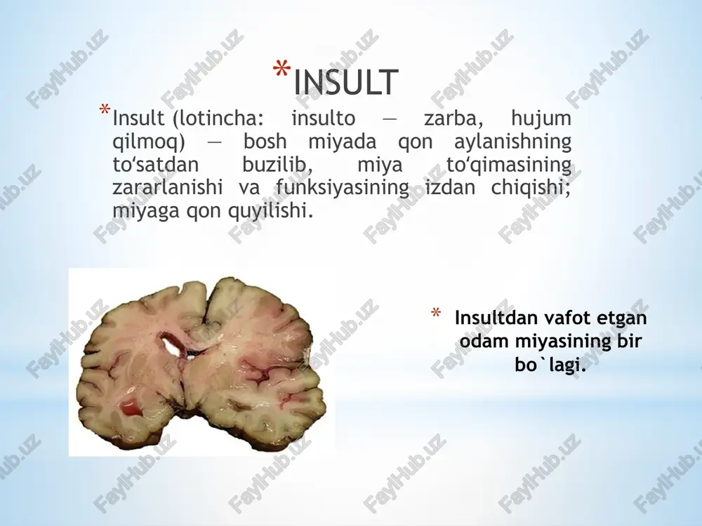 mik insultlar soni oshishi sodir bo`ladi.i insult har xil vaqtda paydo bo`lishi mumkin,lekin ko`pincha ertalab yoki kechasi sodir bo`ladi.o`choqli simptomlar asta sekin bir necha soat,kun,kam hollarda hafta davomida yuzaga chiqadi.10-15% foizida oylar davomida kasallikning sekin”o`smasimon” kechishi kuzatiladi. miya qon aylanishini ishemik buzilishi asosan karotid va vertebro-bazilyar qon aylanish xavzalarida rivojlanadi. 1.karotid insult uchun yarimsharlar yetishmovchiligi xos.insultdan oldin o`tib ketuvchi o`zgarishlar yoki simptomlarning o`zgarib turishi xos.sezgi buzilishi kuzatiladi. 2.vertebro-bazilyar insultda-bosh aylanishi,quloqlarda shovqin,yurganda tentrash,ko`rishning ,nutqning buzilishi kuzatiladi. miya insultlarini asosiy asoratlari: 1.serebral asoratlar: bosh miya shishishi.ishemiya va nekrozga uchragan zona atrofida oraliq zona joylashgan , undan keyin esa shish zonasi. bosh miya shishi bilan kurashish asosiy maqsadlarga kiradi. miya shishida- bosh miya hajmi oshadi,bu esa bosh miya ayrim qismlarining siljishiga olib keladi va dislokatsion simptomlar paydo bo`ladi. 2.yallig`lanish asoratlari: yallig`lanish sindromi ko`pincha gemorragik insultlarda kuzatiladi.yallig`lanish jarayoni o`zidan keyin chandiqli o`zgarishlarni qoldiradi,bu esa yangi simptomlar, sindromlar-tutqanoqlar paydo bo`lishiga olib keladi. e’tiboringiz uchun rahmat …