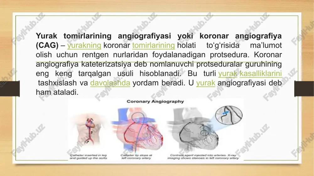 rktida amalga oshiriladi. koronar angiografiya 15 minutdan 30 minutgacha davom etadi, lekin baʼzida turli holatlar tufayli vaqt koʻpayadi. koʻrsatmalarga koʻra, koronar angioplastika va tomirlarni stentlash koronar angiografiya bilan bir vaqtda amalga oshiriladi. koronar angiografiyaning amalga oshirilishi koronar angiografiya shifokorga qon tomirlarida nima notoʻgʻri ekanligini rentgen nurlari bilan aniq koʻrsatadi. qancha koronar arteriyalar yopilgan yoki aterosklerotik blyashka taʼsir qilgani aniq boʻladi. zarar koʻrgan hududlarning aniq joylashuvi maʼlum boʻladi. yurak tomirlarida oldingi operatsiya natijalari baholanadi: koronar arteriyani bypass yoki stentlash, yurak angiografiyasi. koronar angiografiya tugallanganlarni baholashning eng yaxshi usuli hisoblanadi yurak tomirlarida oldingi operatsiyalar. koronar angiografiyadan olingan maʼlumotlar shifokorga koronar arteriya kasalligi, yurak ogʻrigʻi yoki boshqa kasallik uchun qaysi davolash usuli maʼlum bir bemor uchun maqbul ekanligini aniqlashga yordam beradi. natijasi e’tiboringiz uchun raxmat !!! image7.png image8.jpeg image9.jpeg image10.jpeg image11.jpeg image12.jpeg image13.png image3.png image4.png mecto nyhkumn xenyo4ek m yacts neboro nepeguaa mexokenynoukoban betbb oronut or nesoit beveshon aprepiin w cha6xaer kpobbio oba …