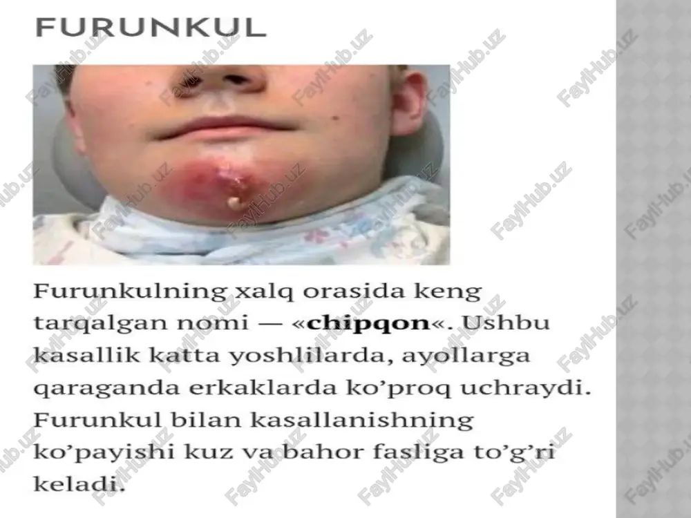 ngini chiqaradi. frunkul oldini olish 1) shaxsiy gigiyenaga rioya qilish 2)immunitetni mustahkamlash (sog‘lom ovqatlanish, vitaminlar, sport) 3)terini har xil jarohatlardan asrash 4)infeksiya belgilari paydo bo‘lsa, shifokorga murojaat qilish 5)frunkul oddiy kasallik bo‘lib tuyulsa ham, noto‘g‘ri muolaja qilinganda flegmona yoki sepsis kabi og‘ir asoratlarga olib kelishi mumkin. 6)shu bois, ayniqsa, yuz yoki bo‘yin sohasida frunkul paydo bo‘lsa, shifokorga murojaat qilish tavsiya etiladi. qaytalanuvchi va ko’p sonli furunkullar kuzatilganda quyidagilar ko’rsatiladi: umumiy qon tashxis/tahlillar/umumiy-qon-tahlili/ va siydik qonda qand miqdorini aniqlash uchun tahlil; siydikni bakteriologik ekish; faringo- va rinoskopiya; burun yon sinuslarning rentgenografiyasi; flyuorografiya; qorin bo’shlig’i a’zolari va buyraklarning ultratovush tekshiruvi. zarur bo’lganda, bemorga qo’shimcha ravishda endokrinolog, gastroenterolog, pulmonolog, otorinolaringolog va boshqa mutaxassislar maslahat beradi. asoratlar rivojlanishini aniqlash uchun -qonni sterillikka baholash, - buyrak ktsi, - bosh miya mrtsi, -lyumbal punktsiya o’tkazish talab qilinishi mumkin. furunkulni gidragenit…… -follikulit, -chuqur trixofitiyada granulyoma, -tugunchali eritema, -kuydirgi kasalliklar -infektsion -kuydirgi-antraks -teri tuberkulyozi, -aktinomikozdan farqlash kerak. furunkulni …