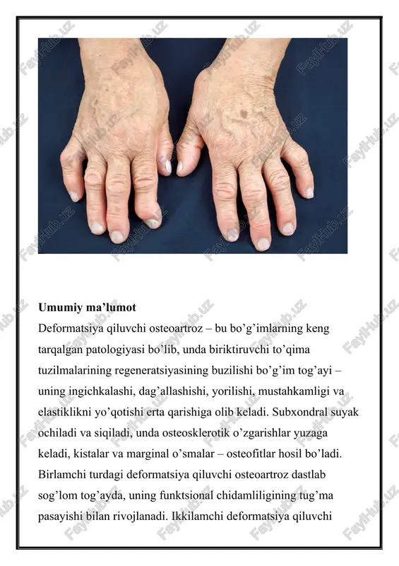 yishi va harakat paytida bo’g’imning siqilishi, mushaklarning o’rtacha atrofiyasi, bo’g’im bo’shlig’ining sezilarli torayishi, suyak to’qimasida sezilarli osteofitlar va subxondral osteosklerozning shakllanishi; · iii – bo’g’imning deformatsiyasi va uning harakatchanligini keskin cheklash, bo’g’im bo’shlig’ining yo’qligi, aniq suyak deformatsiyasi, keng osteofitlar, subxondral kistalar, artikulyar «sichqonchalar» mavjudligi bilan farqlanadi. kellgren va lourens mualliflari radiologik ko’rinishlarsiz deformatsiya qiluvchi osteoartritning 0 bosqichini ajratib ko’rsatishadi. deformatsiyalovchi osteoartroz belgilari deformatsiya qiluvchi osteoartrozning barcha turlari bo’g’imlardagi og’riqlar (artralgiya) bilan tavsiflanadi. og’riqning mexanik turi bo’g’imdagi stress paytida (trabekulyar suyak to’qimalarining mikro sinishi, venoz staz va bo’g’im ichi gipertenziya, osteofitlarning atrofdagi to’qimalarga tirnash xususiyati beruvchi ta’siri, periartikulyar mushaklarning spazmi tufayli) paydo bo’ladi va dam olish paytida yoki tunda susayadi. . «boshlash» og’rig’i qisqa vaqt davom etadi, qo’shma shish va reaktiv sinovitning rivojlanishi natijasida harakatning boshlanishi bilan paydo bo’ladi. bog’imdagi «blokada» og’rig’i davriy xarakterga ega bo’lib, harakat paytida paydo bo’ladi va zararlangan tog’ay («bo’g’im» sichqoncha») bir qismi ikki bo’g’im yuzasi orasiga …
