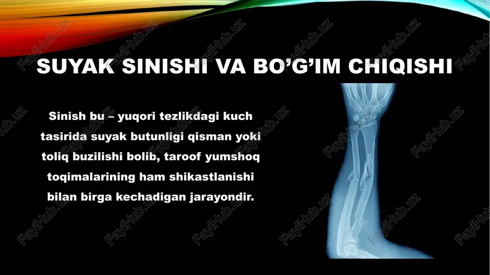 ri ham mavjud. suyak boʻlaklari atrofdagi qon tomirlari va nerv tolalarini jarohatlashi mumkin. bir nechta mayda suyaklar yoki bitta yirik suyak (masalan, son suyagi, chanoq suyagi) singanda ichki va tashqi qon ketishi tufayli travmatik shok vujudga olib keladi. suyak sinishining tashqi koʻrinishdan absolyut (suyak kaltalashuvi, qiyshayishi, sinish sohasida kirtillash) va nisbiy (shish, ogʻriq, funksiyaning buzilishi) belgilari koʻzga tashlanadi. suyagi singan joyni tezda mavjud narsalar (karton, faner, taxtacha va boshqalar) yoki shina qoʻyib, ustidan doka, roʻmol yoki bint bilan siqib bogʻlash va bemorni zudlik bilan tegishli kasalxonaga olib borish zarur. image2.png image3.jpeg image4.jpeg image5.jpeg image6.jpeg image7.jpeg image8.jpeg image9.png image10.jpeg image11.png image12.jpeg image13.jpeg image14.png image15.jpeg image16.jpeg image17.png image1.png types of bone fractures eoeeen: transverse fracture longitudinal fracture oblique bone fracture oblique,bone fracture spiral fracture green stick fracture _comminuted fracture without displacement with displacement /docprops/thumbnail.jpeg suyak sinishi va bo’g'im chiqishi a