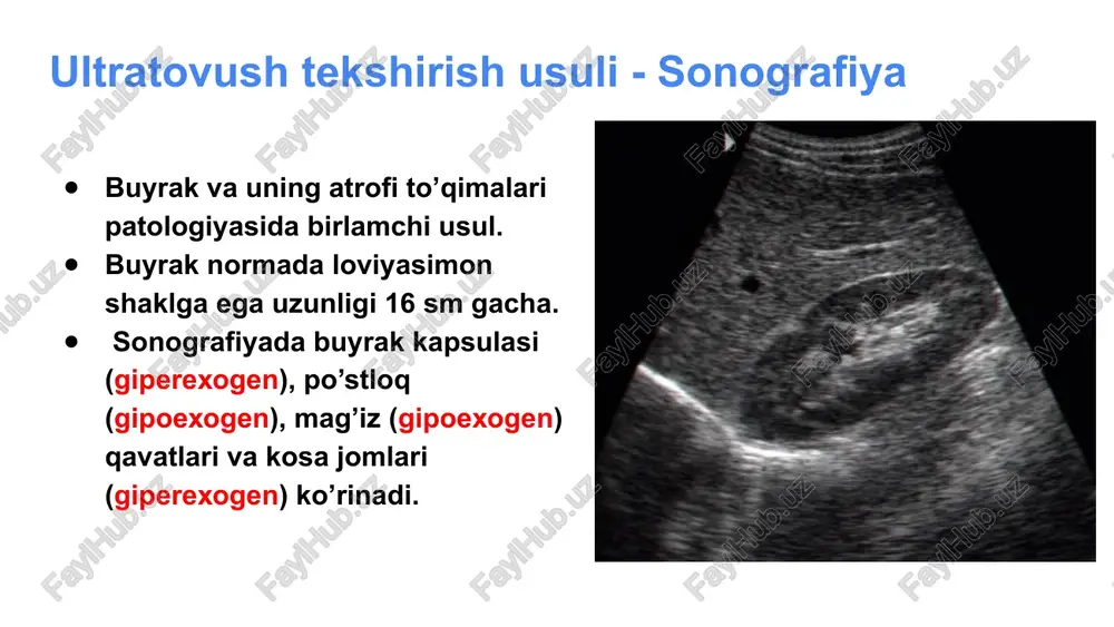 a aniqlash qiyin, chunki normal funksiya bajarayotgan siydik nayini ut orqali ko'ra olmayrniz. rasmda: orgadan olingan buyrak exogrammasi. ikkiga bo'lingan markaziy exokompleks, bertini ustunchasi. bo'ylama olingan exogramma. yuqorigi buyrak kosacha-jomcha tizimi kengaygan, pastki buyrakniki esa minimal kengaygan. ko'ndalang olingan qovuq exogrammasi. ureterosele. ageneziya buyrak rivojlanmay qoladi buyrak usti bezi yaxshiroq ko’rinadi buyrak joylashgan soha bo’sh qoladi taqasimon buyrak buyrakni taqa shaklida bo’lishi asosan pastki qutibi orqali bir-biriga qo’shikib qolishi epigastral sogadan pastroqda datchikni qoyganda yaxshi ko’rinadi siydik qopi utt norma. polipsimon o’sma. buyrak kistalari polikistoz. og’rik, gematuriya, buyrak yetishmovchiligi va gipertenziya sababi bo’lishi mumkin. autosom dominant kasallik, 30 yoshdan keyin uchraydi. ko’pincha ikkala buyrak shikastlanadi. birdaniga kistalar boshqa parenximatoz a’zolarda uchrashi mumkin, bosh miyada esa 10% bemorlarda anevrizmalar. 20% xolatda siydik nayida tosh xosil bo’ladi. kistalar oxaklanishi mumkin. ultrasonografiyada bu kasallik yaxshi aniqlanadi, buyrak kattalashgan, strukturasida ko’p sonli gipoexogen gomogen, chetlari aniq tekis tuzilmalar. ultratovush kuchayish effektini xosil qiladi. abssess …