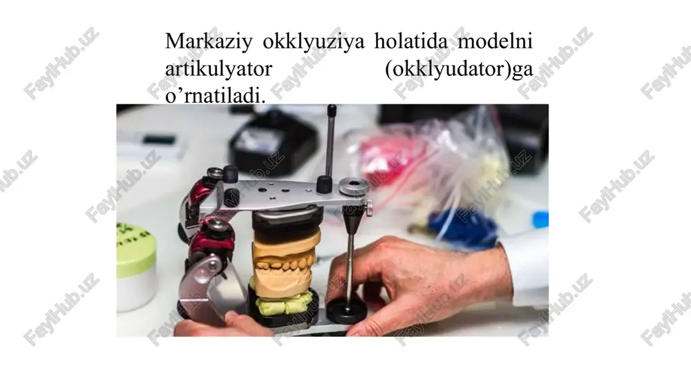 olinmaydigan tishprotezlari bilan protezlash - Page 2