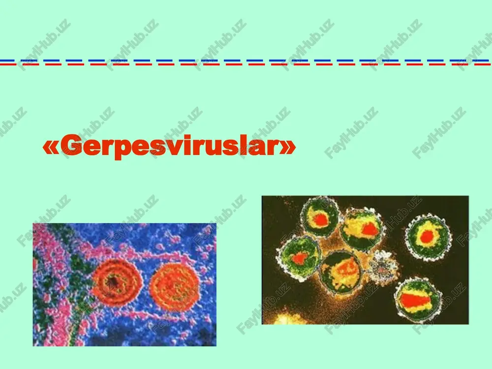 genomiga integrasiya virusning transplasentar o`tishi antigen mimikriya gerpes virusini tuzilishi genom ikki ipli, chiziqli dnk (bir ipi nisbatan kaltaroq). nukleokapsid simmetriyasi kubsimon shaklda morfologiyasi virus sferik shaklda; superkapsid yuzasida glikoprotein o`simtalari mavjud. antigen tuzilishi s-antigen – nukleokapsid oqsillaridan iborat, turga bog`liq bo`ladi (presipitasiya va immunodiffuziya usullarida aniqlanadi); v-antigen – superkapsid glikoproteinklari, turga bog`liq bo`ladi (nr, kbr, ifr). ko`paytirish xujayra kulturalarida (maymun va quyonlar buyrak to`qimasining birlamchi hujayr kulturalari, smv – inson embrioni fibroblastlari, epshteyn -barr, ogv-6, 7 va 8 – t- i v-limfositlarda oddiy gerpes virusi -1, 2 - tovuq embrioning xorion allantois pardasida, laboratoriya hayvonlari organizmida. sitopatik ta`siri – yadro ichi kiritmalari aniqlangan gigant ko`p yadroli hujayralar; smv– sitopatik ta`siri kamroq – yadroda ochiq rangli perinuklear halqasi bo`lgan kiritmalar hasil bo`ladi («ukki ko`zi»). chidamliligi fizik va kimyoviy faktorlar ta`siriga chidamsiz: organik erituvchilar; yuqori harorat; ultratovush, ubn, rn. chidamli : past haroratga (-240s – 1-2 yil, smv dan tashqari); quritilgan …