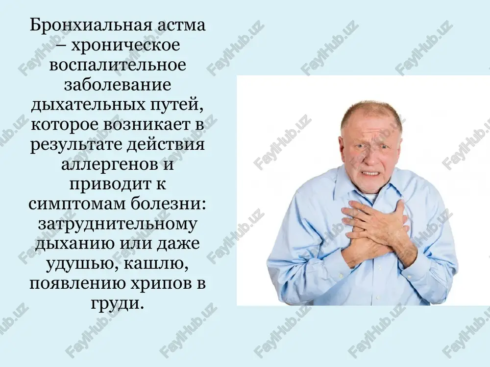 imi simptomami: epizodi zatrudnennogo dixaniya chuvstvo stesneniya v grudi svistyashee dixanie, xripi kashel nalichie simptomov udushya odishka preimushestvenno v utrennee ili nochnoe vremya (okolo 4 chasov utra) posle fizicheskix nagruzok(osobenno v xolodnuyu pogodu) na fone infektsionnogo zabolevaniya verxnix dixatelnix putey pri kontakte s allergenami, takimi kak piltsa, domashniy klesh ili allergeni jivotnogo proisxojdeniya suxie xripi odnovremenno s odishkoy slishni na rasstoyanii «jujjashee» dixanie klyuchevie momenti osmotra vneshniy vid bolnix –ortopnoe? tsvet koji –tsianoz? rech bolnogo – mojet li vigovorit predlojenie ili slovo do kontsa ? auskultatsiya legkix – est li xripi? chastota dixaniya – est li taxipnoe? chastota serdechnix sokrasheniy – est li taxikardiya? klassifikatsii bronxialnoy astmi klassifikatsii bronxialnoy astmi po tyajesti techeniya • legkaya intermittiruyushaya ili epizodicheskaya. kratkovremennie simptomi reje 1 raza v nedelyu. korotkie obostreniya (ot neskolkix chasov do neskolkix dney). nochnie simptomi 80 % ot doljnix. klassifikatsii bronxialnoy astmi • legkaya persistiruyushaya. simptomi ot 1 raza v …
