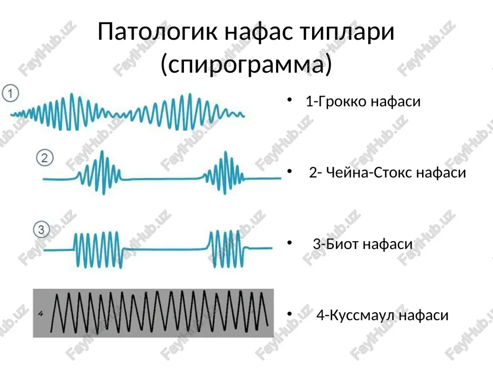 patologik nafas tiplari (spirogramma) - Page 2