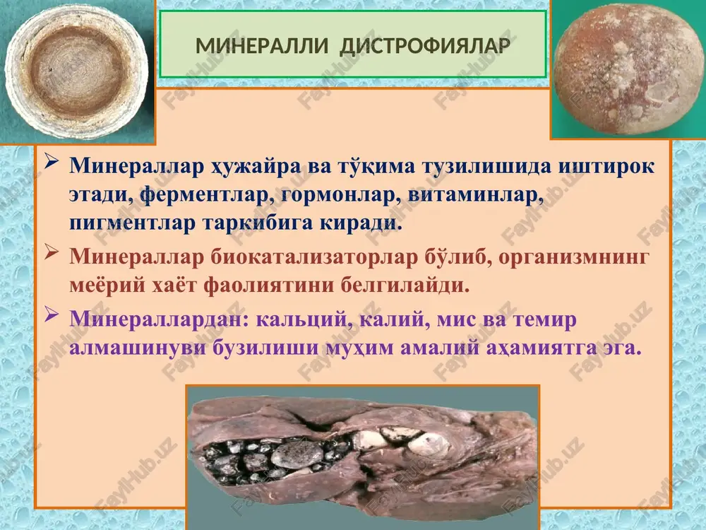 k miokard infarkti buyrak kanalcha nekrozi nekroz – nekros – mahalliy o'lim 1) koagulyatsion nekroz – oqsilga boy to'qimalarda denaturatsiya oqibatida quruq, zich, kulrang-sariq tusdagi nekrozdir. 2) kollikvatsion nekroz – suyuqlikga boy to'qimalarda, nekrozning erishi va kista paydo bo'lishi bilan namoyon bo'ladi. 3) gangrena – tashqi muhit bilan aloqasi bor to'qimalarda, xavo va bakteriyalar ta'sirida qon pigmentlarining temir sulfidga aylanishidan qora rangga kiradi va kuygan jismni eslatadi (gangrena –kuyish degani). 4) sekvestr – autolizga uchramaydigan qattiq to'qima nekrozi (suyak, tog'ay, pay). 5) infarkt – tashqi muhitdan holi,ichki a'zolar ishemik nekrozi. 6) fibrinoid nekroz – biriktiruvchi to'qima va tomir devori nekrozi. 7) suzmasimon nekroz – silga xos quruq, kazeoz nekroz. 8) yotoq yara – uzoq yotganlardagi teri nekrozi. 9) ateromatoz nekroz – arteriya devoridagi bo'tqasimon nekroz. 10) elimsimon nekroz – zaxm gummasidagi elimsimon nekroz. 11) apoptoz – umrini yashab bo'lgan hujayra genli dasturli nekrozi. nekrozning klinik-morfologik formalari 1) koagulyatsion nekroz 2) …
