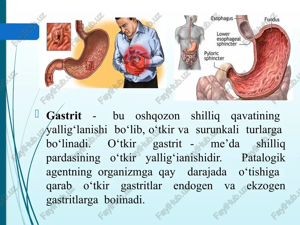qarishining buzilishlari rol o‘ynaydi. davolash jismoniy tarbiyasi uslubi davolash jismoniy tarbiya bu kasallikda og‘riqlaming pasayishidan va dispepsik holatlaming kamayishidan so‘ng tatbiq qilinadi. djtning vositala ri va shakllari, jismoniy mashqlarning bajarilishi va templari, jismoniy mashqlarning yuklamalari va o‘tkazilish vaqti kasal umumiy holatini e’tiborga olgan holda aniqlanadi. birinchi vaqtlarda jismoniy mashqlar faqat davolash va ertalabki gimnastika shaklida o‘tkaziladi, keyin asta-sekin yurishlar, sport mashqlari (suzish, yurish) tatbiq etiladi. bu kasallikda eng yaxshi dastlabki holat - bu chalqancha yotib bajariladigan davolash gimnastika mashqlari. shu bilan birga, chap va o‘ng yonboshda yotgan holatda, qorinda va oyoq-qo‘llarda turgan holatda. davolash kursining oxirida o‘tirgan va turgan dastlabki holatda davolash gimnastika mashqlari bajariladi. jismoniy mashqlar majmuasiga hamma mushaklar guruhi kiritiladi. shunga qaramasdan, yelka va qorinning (press) mushaklariga davolashning boshlanish vaqtida jismoniy mashqlar berilmaydi va qolaversa, bu mashqlar me’da-ichak organlari funksiyasiga ta’sir etadi. jismoniy mashqlar har xil gimnastik anjomlar (gantel, gimnastik tayoq, meditsinbol) bilan o ‘tkaziladi. nafas olish mashqlari …