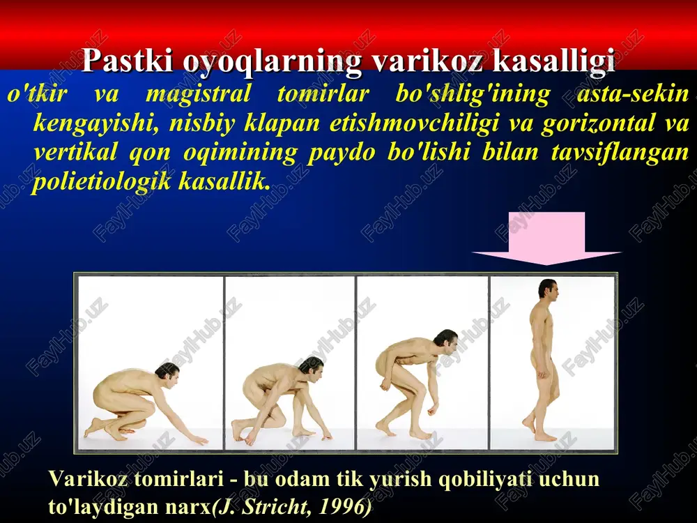 a. svy tasnifi (v.s. savelyev va boshqalar) * ceap tasnifi (1994) c - klinika e - etiologiya a - anatomiya p - patofiziologiya ceap bo'yicha klinik tasnifi c0 - klinikasi yo'q c1 - telangiektaziya c2 - varikoz tomirlari c3 - shish c4 - terining o'zgarishi c5 - davolangan yaralar c6 - ochiq yaralar ceap tasnifi etiologiya (e): evropa ittifoqi - konjenital kasallik ep - asosiy (noma'lum sabab bilan) es - ikkilamchi (ma'lum sababga ko'ra: trombozdan keyingi, travmadan keyingi va boshqalar) patofiziologiya (p): pr - reflyuks po - obstruktsiya pro - reflyuks + obstruktsiya ceap bo'yicha anatomik tasnif poverxnostnie veni teleangioektazii.retikulyarnie veni bpv vishe kolena bpv nije kolena mpv nemagistralnaya glubokie veni nijnyaya polaya obshaya podvzdoshnaya vnutrennyaya podvzdoshnaya narujnaya podvzdoshnaya tazovie obshaya bedrennaya glubokaya bedrennaya poverxnostnaya bedrennaya podkolennaya veni goleni mishechnie – ikronojnie, stopi i dr. perforantnie veni bedra goleni svy sababini aniqlang yuzaki tomirlarning klapan apparati holatini baholang chuqur tomirlarning …