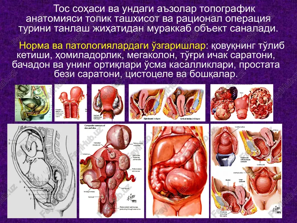 na ga ajratadi. qorinparda osti bo'shlig'i (savum relvis subperitoneale) erkaklarda bu bo'shliqda: qovuq, siydik naylari, to'g'ri ichakning qorinpardadan tashqari qismi, prostata bezi, urug' pufakchalari o'rin olgan. qorinparda va tos diafragmasi orasida joylashgan. qorinparda osti bo'shlig'i (savum relvis subperitoneale) ayollarda esa: qovuq, siydik naylari, to'g'ri ichakning qorinpardadan tashqari qismi, bachadon bo'yinchasi, qin joylashgan. hajmini o'zgartirib turuvchi turli sistemalarga taalluqli a'zolarning borligi fastsial plastinkalar va ular orasida kletchatkalarning paydo bo'lishiga olib kelgan. savum relvis subperitoneale fastsiyalari qorin parda bilan tos diafragmasi orasida joylashgan a'zolar kichik chanoq a'zolari hisoblanadi. endoabdominal fastsiyaning davomi - fasciae endopelvina ning parietal varag'i tos bo'shlig'i devorlarini ichkaridan qoplaydi, vistseral varag'i esa a'zolarni o'raydi. tos ichi fastsiyasining ikkita sagittal va bitta ko'ndalang (denonvile-salishev aponevrozi) ortiqlari chanoq a'zolarini o'rta holatda fiksatsiyalashdan tashqari, yon kletchatkalardan ajratib turadi. savum relvis subperitoneale - kichik chanoq bo'shlig'i savum relvis subperitoneale kletchatka bo'shliqlari tos fastsiyasining parietal varag'idan hosil bo'lgan fastsial ortiqlar hisobiga parietal va vistseral …