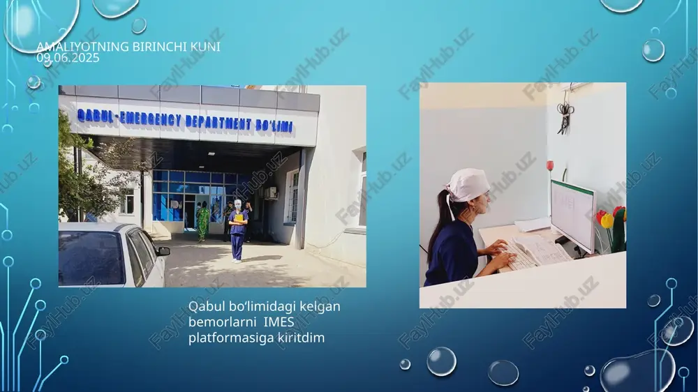 ini oʻlchadim amaliyotning o’n oltinchi kuni 26.06.2025 shifokorlar tomonidan bajarilgan bachadon nayini olib tashlash operatsiyasida qatnashdim amaliyotning o’n yettinchi kuni 27.06.2025 fizioterapiya boʻlimida bemor beliga elektroterapiya qilishni oʻrgandim amaliyotning o’n sakkizinchi kuni 28.06.2025 shifokorlar tomonidan bajarilgan laparoskopik xolesisektomiya operatsiyasi jarayonida qatnashdim amaliyotning o’n to’qqizinchi kuni 30.06.2025 ambulator sharoitda yotib davolanayotgan bemorlarga tomchilatib dori yubordim amaliyotning yigirmanchi kuni 01.07.2025 shikastlanganlar xonasida gipsning tayyorlanish jarayonida qatnashdim va oʻrgandim amaliyotning yigirma birinchi kuni 02.07.2025 fizioterapiya xonasida dorsonval aparatida bemor boshini massaj qildim (tomirlarni kengaytirish va qon aylanishini yaxshilash uchun) amaliyotning yigirma ikkinchi kuni 03.07.2025 shifokorlar tomonidan xoliektomiya operatsiyasi jarayonida qatnashdim amaliyotning yigirma uchinchi kuni 04.07.2025 sanpin qoidalariga asoslanib boʻlimdagi shpiristlarni zarazsizlantirdim amaliyotning yigirma to’rtinchi kuni 05.07.2025 reanimatsiya boʻlimida defibrilyator apparat yordamida axvoli ogʻir bemorga yordam koʻrsatdim amaliyotning yigirma beshinchi kuni 07.07.2025 shifokorlar tomonidan bajarilgan bemorning jarohat joyiga qayta ishlov berish jarayonida qatnashdim amaliyotning yigirma oltinchi kuni 08.07.2025 gigiyena xonasida ona eritma tayyorlashni oʻrgandim …