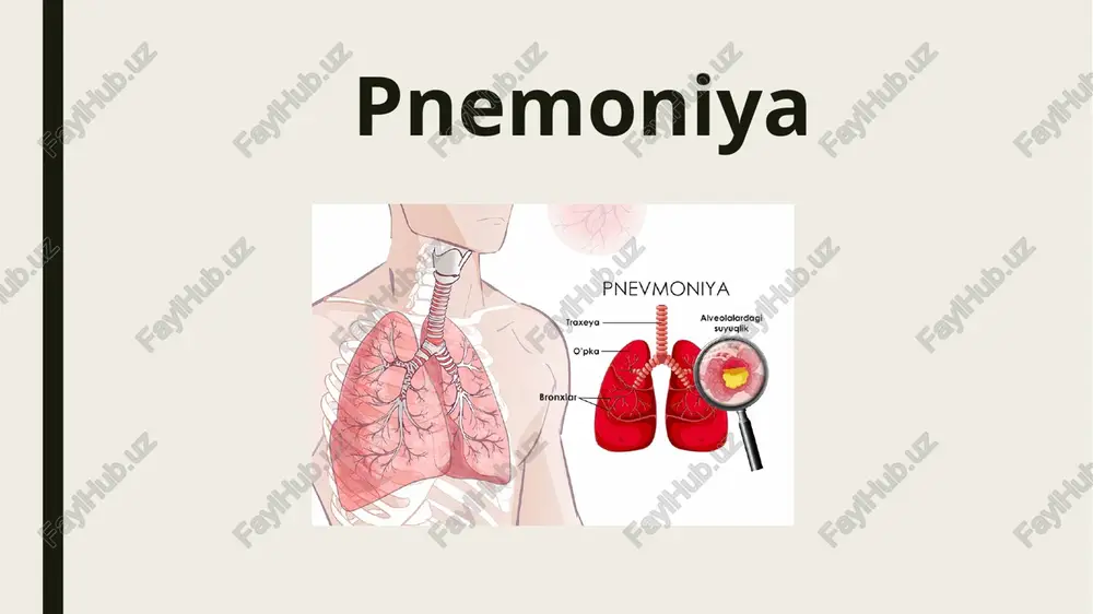 exanizmlardan biri bemorlarga sun'iy o'pka ventilyatsiyasida endotraxeal nayni ishlatishdir. 2. havo-tomchili.bu yo'l bilan yo'qo'zg'atuvchilar o'pkaning respirator bo limlariga havodan nafas olganda o'tadi (pnevmokokk, gemofil tayoqchasi, moraksella,streptokokk, anaeroblar, legionella, mikoplazma, xlamidiya, virus va boshqalar). 3. gematogen yol. bunda mikroorganizmlar septik o'choqlardan sepsis, infeksion endokardit, septik. tromboflebit va boshqalardan o'tadi. 4. kontagioz yo'1. qo shni a'zolarning infeksiyalanishi bilan bog liq (mediatsinit, jigar absessi). pulmonologlarning yevropa hamda amerika torakal jamiyati va v xalqaro kongressida(moskva,1995) klinik-morfologik, patogenetik xususiyatlari, epidemiologik jarayonlarni va qo'zg'atuvchiga qarshi antibiotiklarni empirik tanlash hamda shifokorlarga qulaylik tug dirish maqsadida pnevmoniyaning quyidagi ishchi tasnifi taklif etilgan va u amaliyotda qo llanilib kelinmoqda. tasnifi. 1. kasalxonadan tashqari (sinonimlari uy, ambulatoriya,birlamchi) pnevmoniya. ﻿﻿﻿ 2. kasalxona ichi (sinonimlari - nozokomial, gospital, ikkilamchi) pnevmoniya. bemor kasalxonaga tushgandan 48-72 soatdan keyin rivojlanadi va bu shakli 10-15% ni tashkil etadi. ammo o'lim 30-50% hollarda kuzatiladi. 3. immun tanqisligi (tug'ma immunodefitsit, olt-infeksiyasi) pnevmoniyasi. ﻿﻿﻿4. atipik pnevmoniya - hujayra ichi …