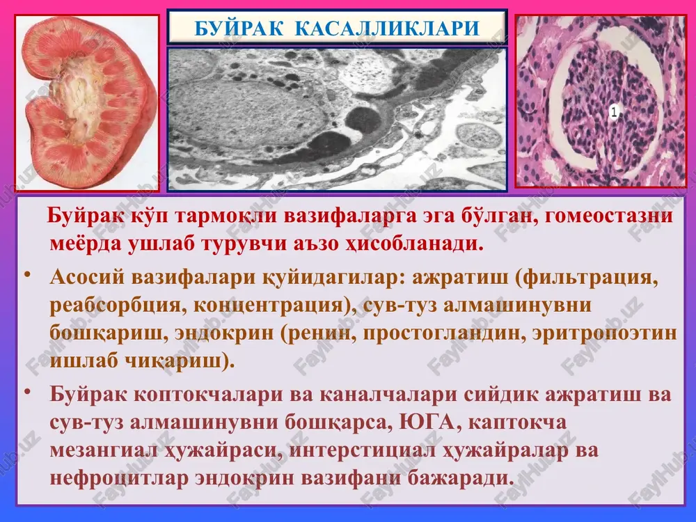va nefrokaltsinozli tubulopatiya. interstitsial kasalliklari: 1) tubulointerstitsial nefrit, 2) pielonefrit. buyrak kasalliklari -glomerulopatiyalar glomerulonefrit glomerulonefrit, bu – infektsion-allergik tabiatli, ikki tomonlama, buyrak kaptokchalarining yiringsiz yallig'lanishli, buyrakka xos va buyrakdan tashqaridagi simptomlar bilan kechuvchi kasallikdir. buyrakka xos simptomlariga proteinuriya, gematuriya, tsilindruriya, oligouriya; buyrakdan tashqarilariga – shish, arterial gipertenziya, yurak gipertrofiyasi, disproteinemiya, giperazotemiya, uremiyalar kiradi. tasnifi. 1) kechishi bo'yicha: o'tkir, avj oluvchi va surunkali; 2) joylanishi bo'yicha: intrakapillyar va ekstrakapillyar; 3) yallig'lanishi bo'yicha: ekssudativ, proliferativ, aralash; 4) kaptokchalarning shikastlanish darajasiga ko'ra: diffuz va o'choqli glomerulonefritlar farq qilinadi. buyrak kasalliklari etiologiyasi. gemolitik streptakokkning nefritogen shtammi, lekin stafilakokk, pnevmokokk, viruslar (gepatit v), oqish trepanema, bezgak plozmodiysi ham sabab bo'lishi mumkin. quyidagi infektsion kasalliklardan: angina, skarlatina, orvi, pnevmoniya, meningokokkli infektsiya, bezgak, bakterial endokardit, zaxmdan keyin ikkilamchi kasallik ko'rinishida rivojlanadi. patogenezi. ikkita immunopatologik mexanizm mavjud: 1) kaptokchalar kapillyarlari bazal membranasiga qondagi eruvchan immun birikmaning o'tirishi, leykoxemotaksis, neytrofil leykotsitlar faollashuvi, ularning lizosomal fermentlari bazal membranani lizislashi va …