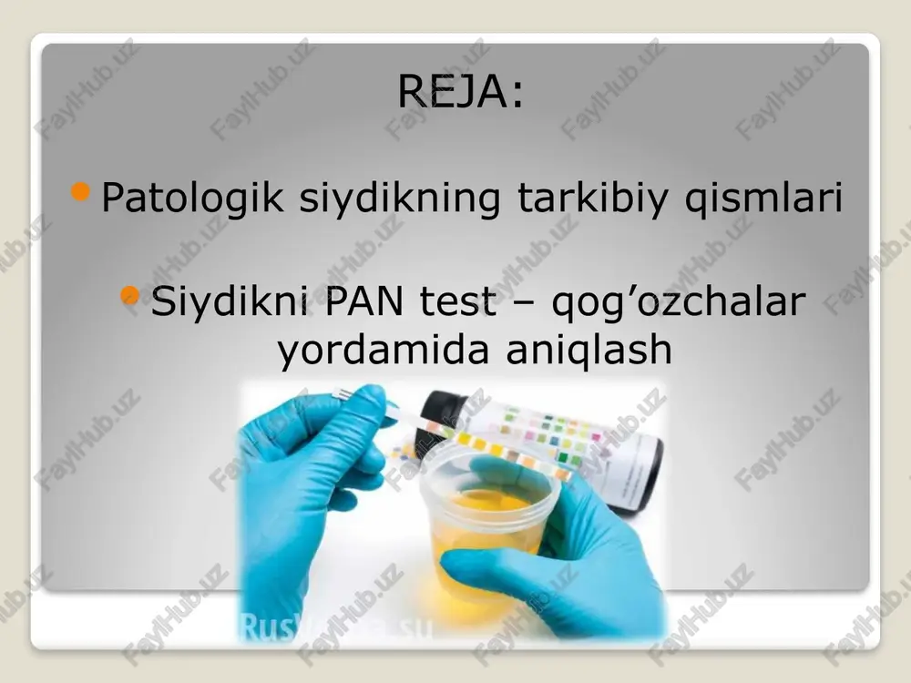 reaksiyasi isitmalagan holatlarda, qandli diabetda (ayniqsa, siydikda keton tanachalar bo‘lganda), ochlikda va organizmdagi boshqa o‘zgarishlarda kuzatiladi. siydikni ishqoriy reaksiyasi sistit va piyelitlarda (siydik qopi bo‘shlig‘ida mikroorganizmlar siydikchilni ammiakkacha parchalaydi), kuchli qusiqdan keyin, ba’zi dorilar qabul qilganda (masalan, bikarbonat natriy), ishqoriy mineral suvlar iste’mol qilganda va boshqalarda kuzatiladi. 14 me’yorda siydikning rangi somon – sariqdan to‘q sariqqacha bo‘ladi. siydik rangi undagi pigmentlar – uroxrom, urobilin, uroeritrin, urozein va boshqalarni saqlanishiga bog‘liq. to‘q sariq rangga ega bo‘lgan siydik odatda konsentrlangan, yuqori zichlikka ega va nisbatan kam miqdorda ajralib chiqadi. och sariq (somon) rangidagi siydik past zichlikga ega bo‘lib, ko‘p miqdorda ajralib chiqadi. homilador ayollarda siydik rangi normadagi siydik rangi patologik hollarda siydikni rangi qizil, yashil, jigar rang va boshqalar bo‘lishi mumkin. bu unda me’yorda uchramaydigan bo‘yovchi moddalarni mavjudligiga bog‘liq. masalan: qizil yoki pushti–qizil rang gematuriya va gemaglobinuriyada, shuningdek, antipirin, amidopirin, santonin va boshqa dori moddalarni qabul qilgandan keyin kuzatiladi. jigarrang yoki qizil–qo‘ng‘ir …