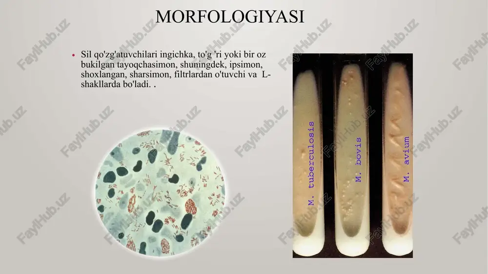 sil kasalligining mikrobiologik diagnostikasi - Page 2