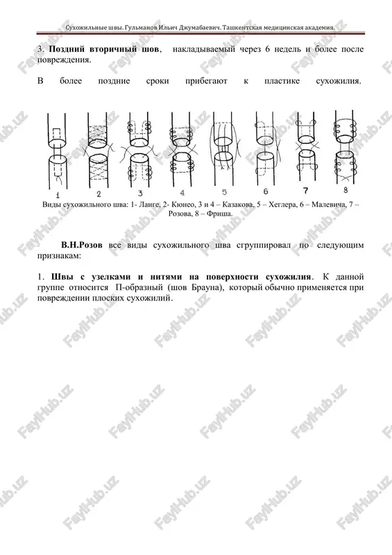 dprinimaetsya v pervie 4-6 nedel; i suxojilnie shvi. gulmanov ilich djumabaevich. tashkentskaya meditsinskaya akademiya. 3. pozdniy vtorichniy shov, nakladivaemiy cherez 6 nedel i bolee posle povrejdeniya. v bolee pozdnie sroki pribegayut k plastike suxojiliya. vidi suxojilnogo shva: 1- lange, 2- kyuneo, 3 i 4 – kazakova, 5 – xeglera, 6 – malevicha, 7 – rozova, 8 – frisha. v.n.rozov vse vidi suxojilnogo shva sgruppiroval po sleduyushim priznakam: 1. shvi s uzelkami i nityami na poverxnosti suxojiliya. k dannoy gruppe otnositsya p-obrazniy (shov brauna), kotoriy obichno primenyaetsya pri povrejdenii ploskix suxojiliy. suxojilnie shvi. gulmanov ilich djumabaevich. tashkentskaya meditsinskaya akademiya. shvi s uzlami: 1 — uzli snaruji na odnoy storone, 2 — uzli snaruji na raznix storonax. 2. vnutristvolnie shvi s uzelkami i nityami na poverxnosti suxojiliya. k dannoy gruppe otnositsya shov lange, obladayushiy soglasno ispitaniyam malevicha naibolshey soprotivlyaemostyu razrivu. uproshennuyu, vesma zaslujivayushuyu modifikatsiyu shva lange daet frish, noviy je suxojilniy shov …