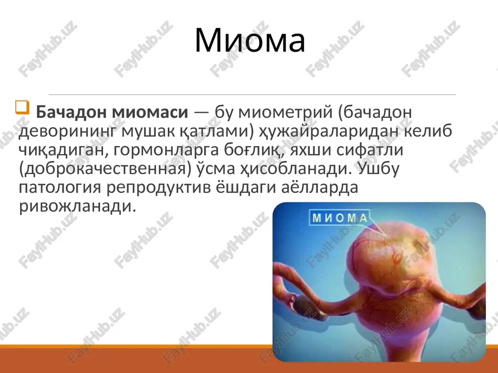 oma rivojlanish xavfi ortishi — chunki organizmda androgenlar estradiolga aylanadi (aromatizatsiya jarayoni), bu esa estrogen darajasini oshiradi. immun tizimining roli — immunitetdagi buzilishlar organizmning anomal hujayralarga qarshi kurash qobiliyatini kamaytiradi, bu esa miomaning rivojlanishiga olib kelishi mumkin. tabiiy killer hujayralar darajasining oshishi — organizmda anomal hujayralarga qarshi immun javob kuchayadi, lekin bu holat mioma rivojlanishi bilan bog'liq bo'lishi mumkin. t-limfotsitlar darajasining pasayishi — immunitetning umumiy faolligi kamayadi, bu esa o'sma hujayralarining nazoratsiz ko'payishiga olib kelishi mumkin. periferik t-xelperlar darajasining oshishi — immun javobni rag'batlantiradi, ammo bu ham miomatoz o'zgarishlar bilan bog'liq bo'lishi mumkin. immun tizimidagi buzilishlar darajasi miomatoz tugunlar soni bilan korrelyatsiya qiladi — ya'ni, tugunlar soni ko'paygan sari immun o'zgarishlar ham kuchayadi. miomatoz tugunlar soni oshganida v-limfotsitlar darajasi pasayadi — bu gumoral immunitetning zaiflashishiga sabab bo'lishi mumkin. faktori riska snijenie riska: 1.priem kok 2.fizicheskaya aktivnost 3.kurenie 4.bolee 3 rodov v anamneze povishenie riska: 1.ranneemenarxe 2.otsutstvie rodov v anamneze 3.pozdniy …