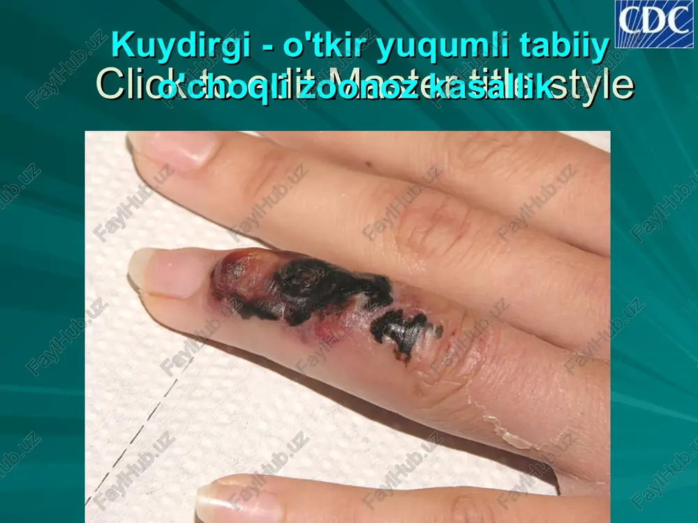 loroda obrazuetsya ogromnoe kolichestvo spor, kontaminiruyushix zemlyu. click to edit master title style click to edit master title style epizootologiyasi kuydirgi bilan deyarli barcha hayvonlar, shu jumladan uy hayvonlari (yirik shoxli qoramol – sigirlar, buqalar, ho'kizlar..., mayda shoxli qoramol - qo'ylar, echkilar..., otlar, eshaklar, tuyalar va h.k.) ham og'rishi mumkin click to edit master title style epizootologiyasi alimentar yo'l – o'tlab yurganda suv va o'tlarni iste'mol qilganda sporalarni yutish orqali; hayvonlar kasallikni quyidagi yo'llar orqali yuqtiradi: click to edit master title style epizootologiya transmissiv yo'l – hayvonlarni so'nalar, boshqa qon so'ruvchi pashshalar chaqqanda click to edit master title style epizootologiyasi kuydirgi hayvonlarda o'tkir yoki «yashin tezligida kechuvchi» tarqoq kasallik ko'rinishida kechib, 95% hollarda jonivorning halokati bilan yakunlanadi click to edit master title style epidemiologiyasi odam uchun kasallik manbai bo'lib kasallangan hayvonlar, avvalo uy hayvonlari hisoblanadilar click to edit master title style epidemiologiyasi kuydirgi sog'lom odamga quyidagi yo'llar bilan yuqishi mumkin: …
