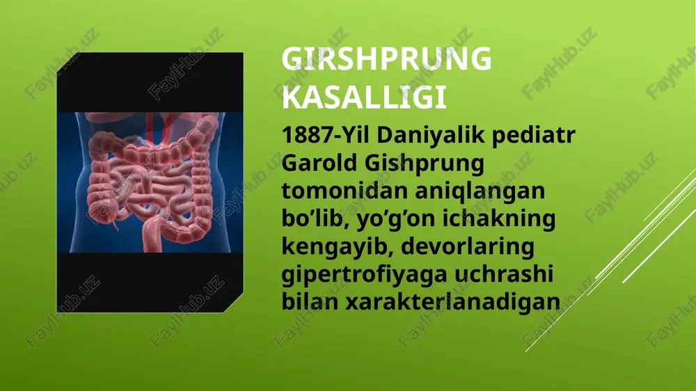 i yoki konsentratsiyaning pastligi ogir oqibatlarga olib kelishi suvdan zaxarlanish xolatlarini keltirib chiqarishi mumkin kontrast:bariy sulfat rektal yuborib aniqlanadi utt diferensial diagnostika ichak tutulishlari. yo’gon ichak va orqa chiqaruv teshigi stenozi disbakterioz yo’g’on ichak atreziyalari megakolon davolash tez va radikal operativ davo kolostoma qo’yib operatsiya qilish konservativ davolash konservativ davolash ich yurishini yaxshilaydigan preparatlar parxez taomlar gimnastika lfk tozalovchi va sifonli xuqnalar operativ davolash polliativ operatsiya-kolostoma. radikal operatsiya: svenson-isakov duamel-bairov soave-lyonyushkin rebayn qorin oraliq proktoplastik operatsiyalar operativ usullar dolixosigma dolixosigma bu sigmasimon ichak va uning tutqichini uzunligini anomal oshishiga yogon ichak motorikasi funksiyasining buzilishiga aytiladi klinika lakto va bifidofloraning titrlari tushishi sababli immunitet tushishi axlat massalarini to’planishi xisobiga ichakdagi spazm qorin pastki qismidagi retsidivlanuvchi og’riqlar meteorizm, surunkali qabziyat bir xaftagacha tashqi korikda tana vaznining kamayishi rivojlanishdan orqada qolish teri qoplamlarining oqarishi palpatsiyada: palpatsiyada axlat massalarining ichak petlyalarida toplanishi aniqlanadi instrumental diagnostika asosiy: irriggrafiya metodidan foydalaniladi asosiy irrigografik simtomlar sigmasimon ichak …