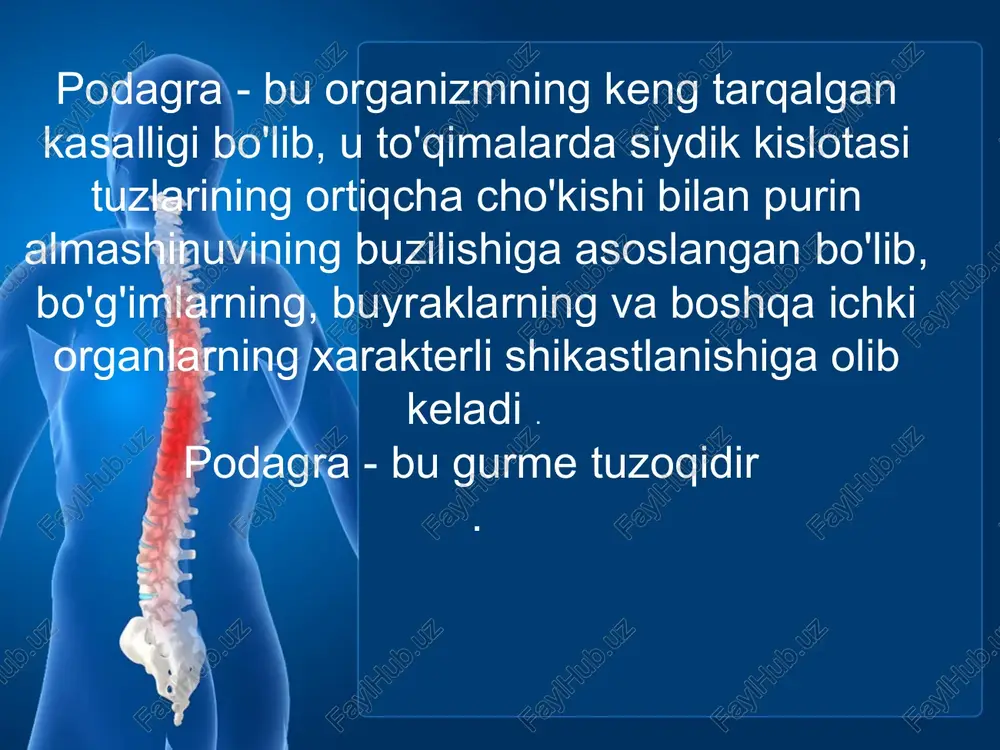 rning rivojlanishi metabolik buyrak aralashgan. urikozuriya darajasiga ko'ra, giperurikemiyaning 3 turi va shunga ko'ra, podagraning 3 turi ajralib turadi: metabolik turi bemorlarning 60% da uchraydi yuqori uraturiya (kuniga 3,6 mmol dan ortiq) siydik kislotasining normal kliriensi. buyrak turi bemorlarning 10% da uchraydi past uraturiya bilan namoyon bo'ladi (kuniga 1,8 mmol dan kam) siydik kislotasining klirensi (3,0-3,5 ml/min). aralash turi bemorlarning taxminan 30% da uchraydi normal yoki kamaygan uraturiya bilan tavsiflanadi siydik kislotasining normal tozalanishi. sog'lom odamlarda siydik kislotasining klirensi 6-7 ml / min, kunlik uraturiya - 1,8-3,6 mmol (300-600 mg). o'tkir podagra artriti uchun klassifikatsiya mezonlari ( sl wallace va boshq. 1977 ) bo’g’im suyuqlikda xarakterli kristalli uratlarning mavjudligi kimyoviy va polarizatsiya mikroskopiyasi bilan tasdiqlangan kristalli uratlarni o'z ichiga olgan tofuslar mavjudligi quyida keltirilgan 12 ta xususiyatdan 6 tasining mavjudligi anamnezda o'tkir artritning bir nechta hujumi bo’g’imlarning yallig'lanishi kasallikning birinchi kunida eng yuqori nuqtaga etadi monoartrit ta'sirlangan bo'g'im terisining giperemiyasi …