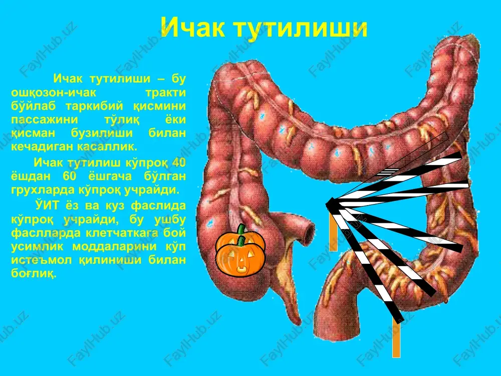 80% 65% simptomlar kvadrati qorin shishishi axlat va gaz tutilishi og'riq ko'ngil aynash va qusish axlat va gaz tutilishi bor yo'q vaqt ko'ngil aynash va qusishning uchrashi 73% 60% 80% og'riq axlat va gaz tutilishi simptomlar kvadrati ko'ngil aynash va qusish qorin shishishi qusish yo'q bor vaqt qorin shishishining uchrashi 80% 75% 82,5% simptomlar kvadrati og'riq axlat va gaz tutilishi ko'nigl aynash va qusish qorin shishishi qorin shishishi chandiqli, yuqori va dinamik ichak tutilishi. yo'q umumiy qorin shishishi lokal asimmetriya diagnostik algoritm a. anamnez yig'ish b. ob'ektiv ko'rik 1. umymiy ko'rik 2. ob'ektiv qorin ko'rigi a) ad oculus b) churra darvozalari ko'rigi v) palpatsiya g) perkussiya d) auskultatsiya e) o'itga xos simptomlar j) per rectum v. instrumental tekshiruvlar g. laborator tekshiruvlar anshyutts (buvre) simptomi - ichak tutilishi sababi yug'on ichak distal qismlarida joylashganda ko'r ichakning shishishi. shlange simptomi – ko'rinadigan ichak peristaltikasi. val simptomi ko'rinadigan peristaltika yuqori timponit ko'rinadigan asimmetriya …
