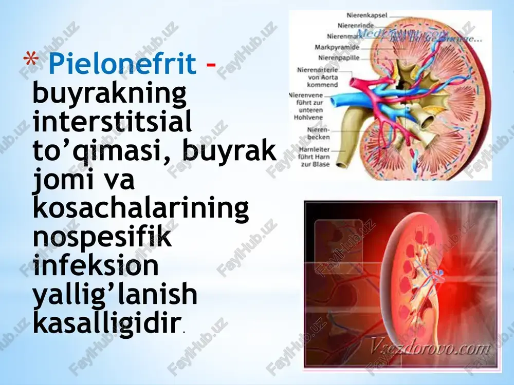 'rayish davrida yuqori harorat, et uvishishi va ko'p terlash, hamda zaharlanish va dizuriya belgilari bilan (siydikni kam miqdorda tez-tez, achishib ajralishi) kuzatiladi. klinikasi: o'tkir pielonefrit 3. siydik ajralishining buzilishi - odatda poli- uriya va pollakiuriya (tez-tez peshob ajralishi) - bir kecha-kunduzi bemorlar 2 litrdan ortiq siydik chiqa- radilar. siydik chiqishi uretraning boshida yoki oxi- rida achishish, qichishish alomatlari bilan kuzatila- di. bemorlarni doimo noxush sezgilar - siyishga bo'lgan istak va oxirigacha siyaolmaslik holatlari bezovta qila- di. bir necha daqiqa o'tgach bemorlar xojatxonaga yugu- radilar va 2-3 tomchi siydikni qiyinchilik bilan ajratadi. sur pielonefrit 2. ko'rish. bemorning umumiy holati uzoq vaqt qoniqarli saqlanadi. teri rangi bo'zargan, yuzi ko'pchigan va ko'z osti xaltacha bo'lib osilib turadi. til quruq, qizil, kulrang qarasht bilan qoplangan. xastalikning buyrak faoliyati etishmovchiligi bilan kuzatiladigan oxirgi bosqichida og'izda xarakterli hid, gemorragik diatez belgilari (burundan va milkdan qon ketishi) namoyon bo'la- di. surunkali pielonefritda odatda shish yo'q. xasta- lik …