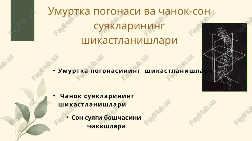iga rotatsiyalangan chanoq xalqasi oldingi xalqasi sinishida: oyoqlar chanoq son va tizza bo'g'imlarida bukilgan.(qurbaqa oyoqlari) qov simfizi uzilganda, oyoqlar chanoq sonda bukilgan, kurilish kuchli og'riqqa sabab bo'ladi. jaroxat soxasida dimiy og'riq kuzatiladi. bemor aktiv va passiv xarakatlarida og'ri kuchayadi. simptomatikasi varnel simptomi yonbosh suyagi qanotlariga bosilganda og'riq kuchayadi larreya simptomi yonbosh suyaklari soxasidan chanoq yozilganda og'riq kuchayishi sichqoncha simptomi yonbosh suyagidan qov suyagiga qarab vertikal yo'nalishda bosilganda og'riq drachuk simptomi dumg'aza soxasiga engil va ritmik bosish natijasida og'riq rentgenografiya kontrast usullar (uretrografiya, tsistografiya, angiografiya.) kompyuter tomografiyasi. magnit-rezonans tomografiya. diagnostikasi konservativ davolash usullari bemorni qattiq yuzaga yotqizish. volkovich xolatida davolash (qurbaqa xolati). maxsus moslamalarni qo'llash (chanoq belbog'i, gamak). chanoq xalqasi vertikal yo'nalishda qiljiganda son suyagi do'nglararo skelet tortma qo'yish. chanoq xaqasi orka xaqasi zararlanganda shkolnikov-selivanov bo'yicha blokada. shkolnikov-selivanov bo'yicha blokada simptom ortolani-marksa – shiqillash simptom barlou- sonning orqaga siljishi simptom galeatstsi – sonning qisqarishi son abduktsiyasining chegaralanish simptomi teri burmalari asimmetriyasi …