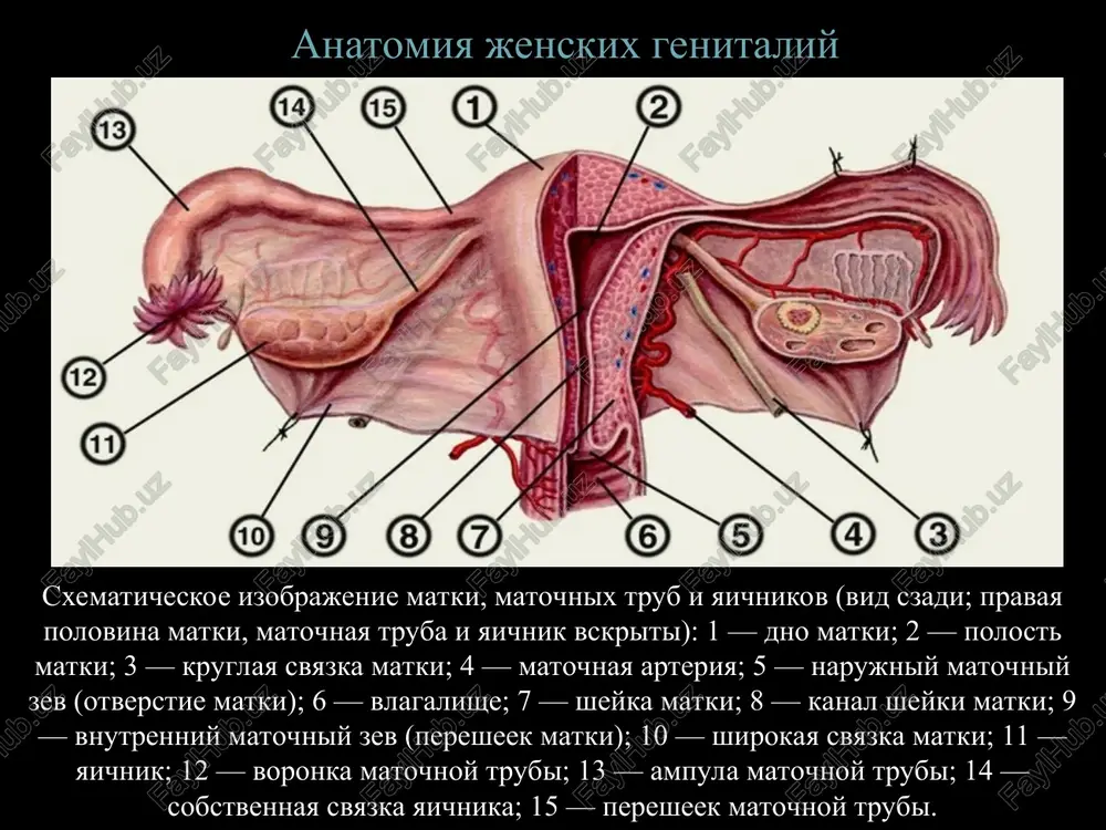 adenokartsinoma – eto rak, kotoriy proisxodit iz jelezistoy tkani matki (vnutrenniy sloy matki, ili endometriy). leyomiosarkoma – eto opuxol, kotoraya proizrastaet iz mishechnogo sloya matki. svetlokletochnaya (mezonefroidnaya) adenokartsinoma; • ploskokletochniy rak; • jelezisto-ploskokletochniy rak; • nedifferentsirovanniy rak. formi rosta raka tela matki: ekzofitnaya (v 95% sluchaev nablyudeniyax), endofitnaya i smeshannaya (5%). i tip — gormonalnozavisimiy. xarakterizuetsya razlichnimi proyavleniyami xronicheskoy giperestrogenii v sochetanii s narusheniem jirovogo i uglevodnogo obmena. opuxol voznikaet na fone giperplasticheskix protsessov endometriya i atipicheskoy ego transformatsii. ii tip - avtonomniy patogeneticheskiy variant - nablyudaetsya u 30 – 40 % jenshin starshe 50 let v postmenopauze. soputstvuyushie endokrinno - obmennie narusheniya menee virajeni ili otsutstvuyut. opuxol voznikaet na fone atrofii endometriya, xarakterizuetsya nizkoy stepenyu differentsirovki, glubokoy invaziey miometriya, obladaet visokoy potentsiey k metastazirovaniyu i imeet sootvetstvenno xudshiy prognoz. videlyayut dva patogeneticheskix tipa raka tela matki: videlyayut tri osnovnix puti metastazirovaniya raka tela matki: limfogenniy, gematogenniy i implantatsionniy. naibolee …