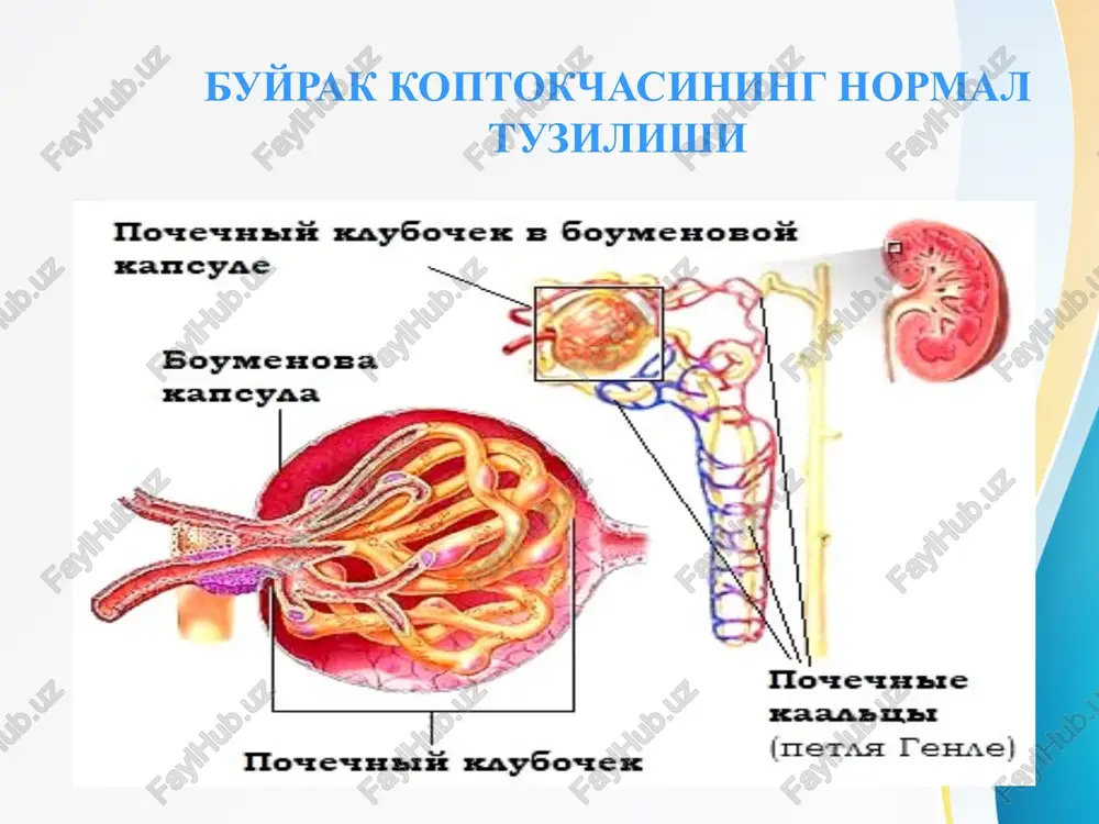 merulonefrit bolalarda streptokokkli infektsiyalar piodermiya skarlatina angina tonzillit xavf omillari ekzogen omillar: bakteriyalar viruslar parazitlar zamburug'lar dorilar endogen omillar: sistemali qizil yugirikdagi yadroli antigenlar revmatoid artritdagi immunoglobulin qalqonsimon bezning buyrak naychasi epiteliyasiga antigeni o'sma antigenlari o'tkir glomerulonefritning patogenezi patogenezda turli immunologik buzilishlar kuzatiladi antitelolarning xosil bo'lishi. antigen-antitelo kompleksi buyrak membranasiga o'tiradi. antigen-antitelo reaktsiyasi buyrak membranasida bo'ladi, bunda kompliment, biologik aktiv moddalar: gistamin, gialuronidaza ishtirok etadi, butun organizm kapillyarlari zararlanishi mumkin. streptokokkli infektsiyada streptokokk antigeni buyrak kapillyarlari endoteliysi, bazal membrana, buyrak naychalari epiteliysini zararlaydi – autoantitelolar xosil bo'ladi, antigen-antitelo reatsiyasi rivojlanadi. antigen o'rnida zararlangan xujayralar bo'ladi. buyrak bazal membranasi va streptokokk umumiy antigen strukturaga ega, shuning uchun streptokokkning normal antitelosi bir vaqtning o'zida bazal membranani xam zararlaydi - kesishgan reaktsiya paydo bo'ladi. glomerulonefrit patogenezi sxemasi streptokokk antigenlari streptokokk antigenlari ag+at auto at auto ag komplement t-supressorlar tanqisligi t-killer lar gzt mediator lari xujayra infiltra- tsiyasi xujayra lizisi xujayra prolifera tsiyasi surunkali …