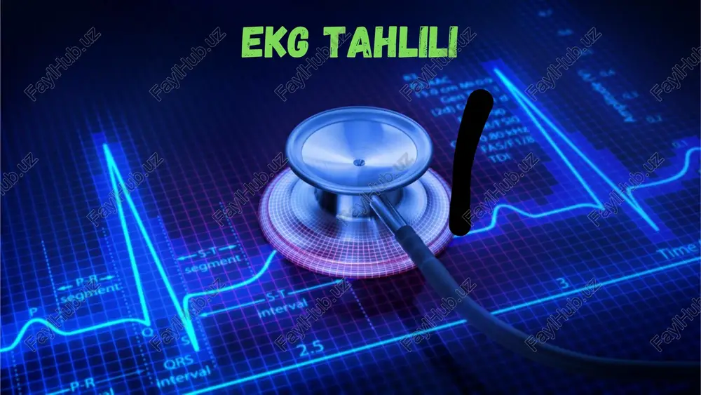 7. ekg'ga xulosa yasash ekg tahlil qilish tartibi: yurak ritmi tahlili 1. yurak ritmi muntazamligini baholash 2. qoʻzgʻalish manbayini aniqlash 3. yurak qisqarishlari sonini sanash muntazam ritm (toʻgʻri, regulyar) nomuntazam ritm (notoʻgʻri, noregulyar) yurak ritmi muntazamligini baholash nomuntazam ritm sinusli ritm sinussiz ritm qoʻzgʻalish manbayini aniqlash bunda yurak qaysi sohadan chiqayotgan impuls hisobiga qisqarayotgani aniqlanadi. • ritm sinusli boʻlishi uchun p tishcha musbat boʻlishi va qorincha kompleksidan oldin kelishi kerak sinussiz ritm 1. yozish tezligi 2. kontrol millivolt 3. ekg tarmoqlari 1. yurak ritmi muntazamligini baholash 2. qoʻzgʻalish manbayini aniqlash 3. yurak qisqarishlari sonini sanash tahlil qilamiz e'tiboringiz uchun rahmat! @dofamin_jamoasi@dofamin_jamoasi @dofamin_jamoasi ijtimoiy tarmoqdagi sahifalarimizga obuna boʻling